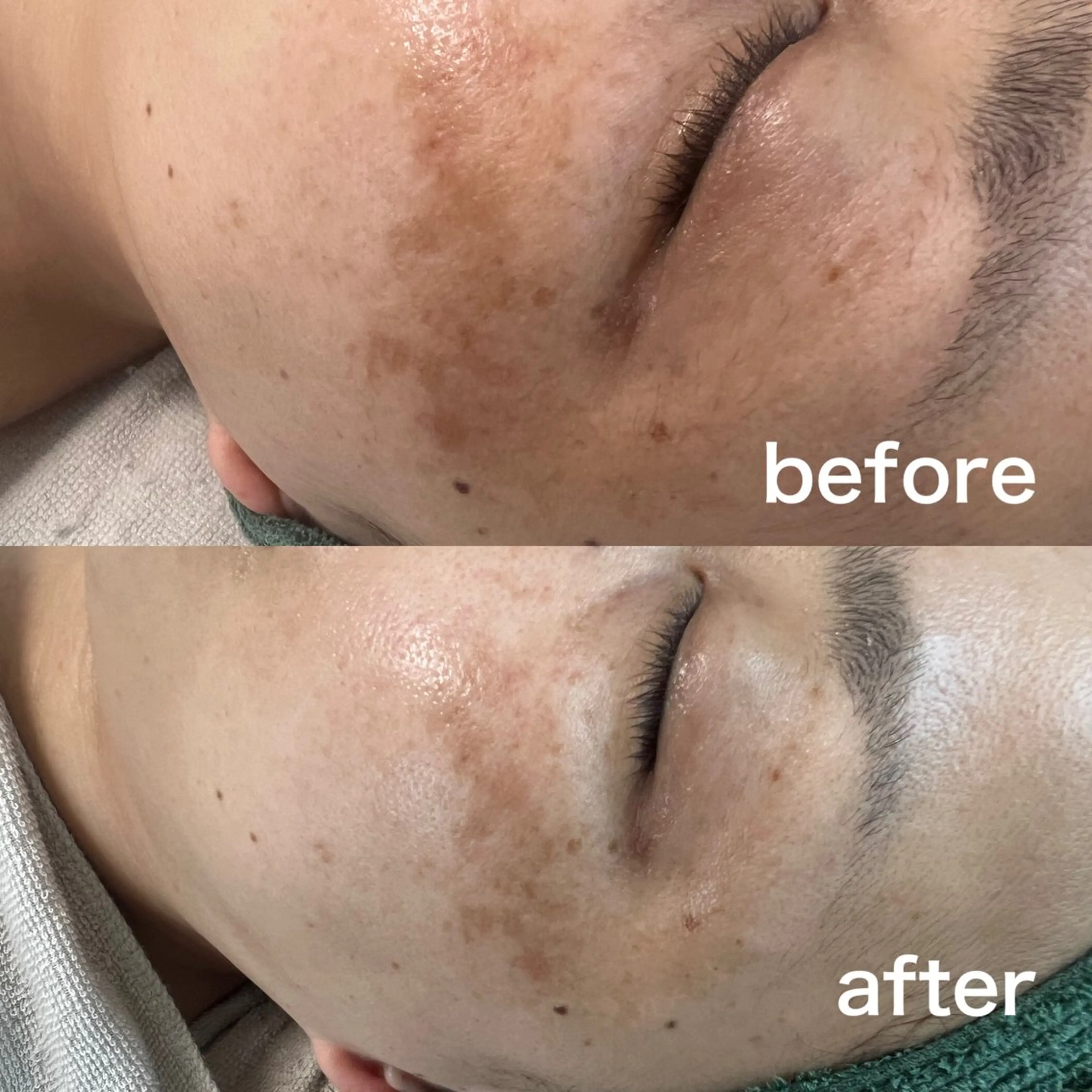 エステ 香川 瑞萌のエステ・リラクイメージ