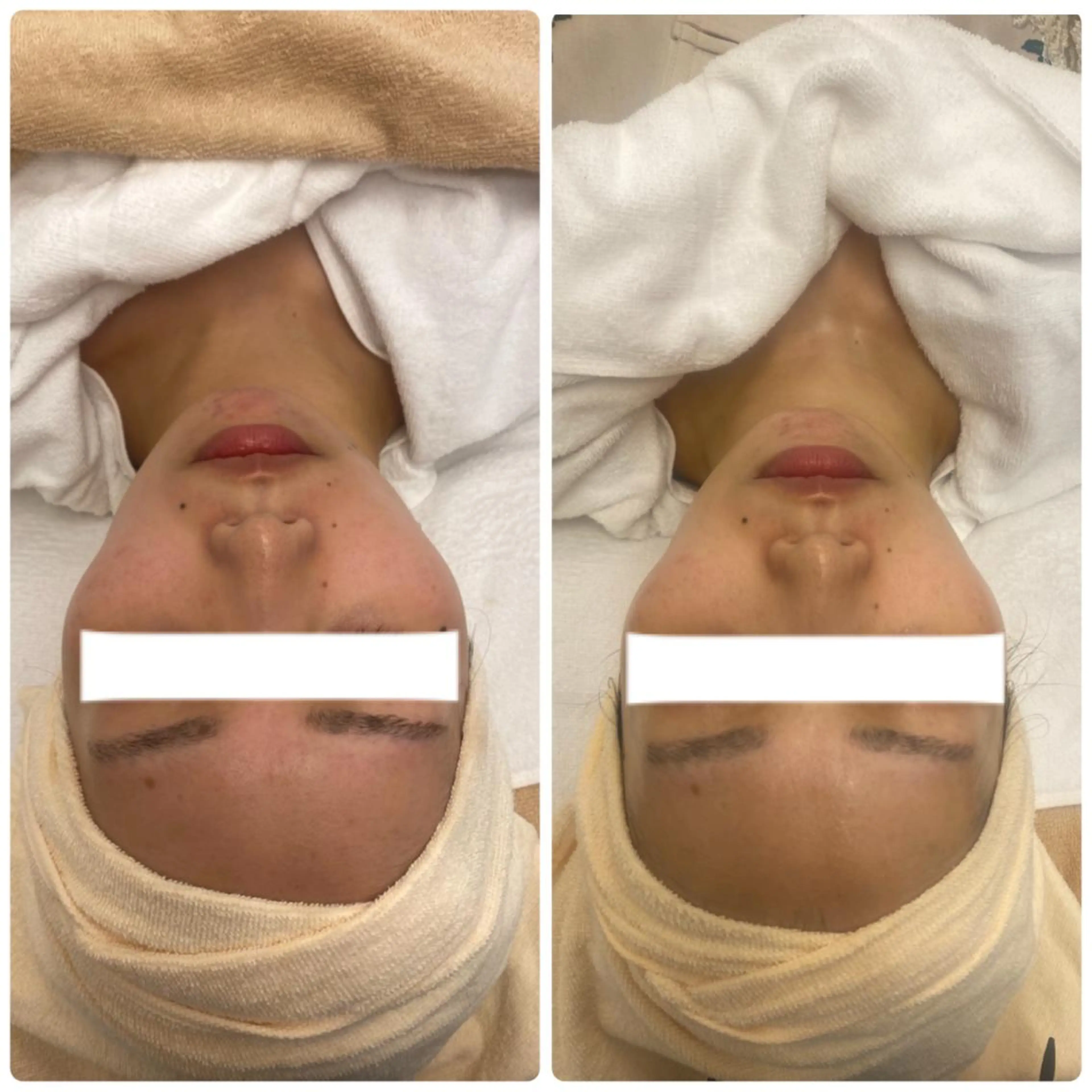 アイブロウ エステ リラク 肌質改善美容サロン ému 用賀のエステ・リラクイメージ