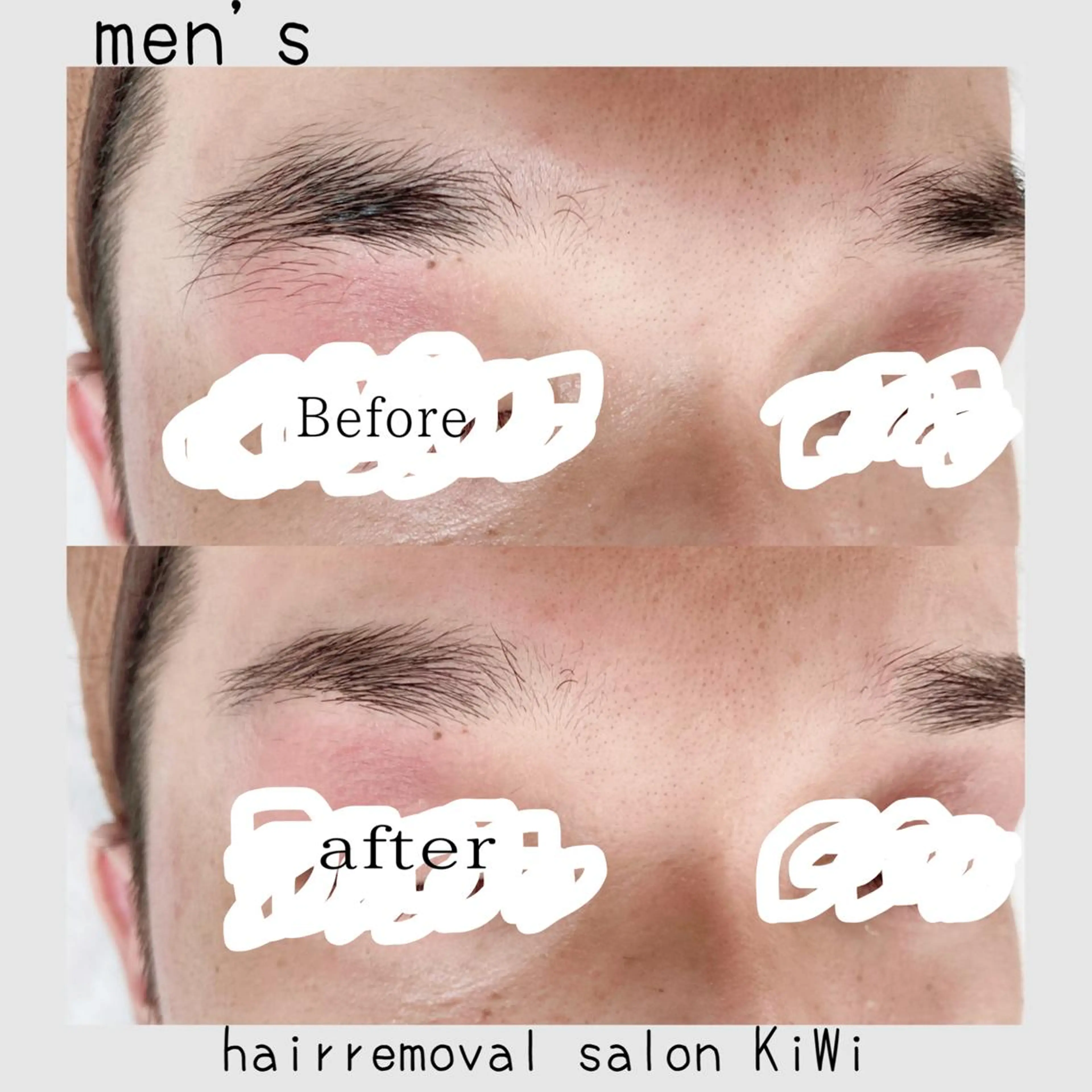 メンズ アイブロウ メンズアイブロウ 眉毛ワックス脱毛 脱毛サロン KiWiのエステ・リラクイメージ