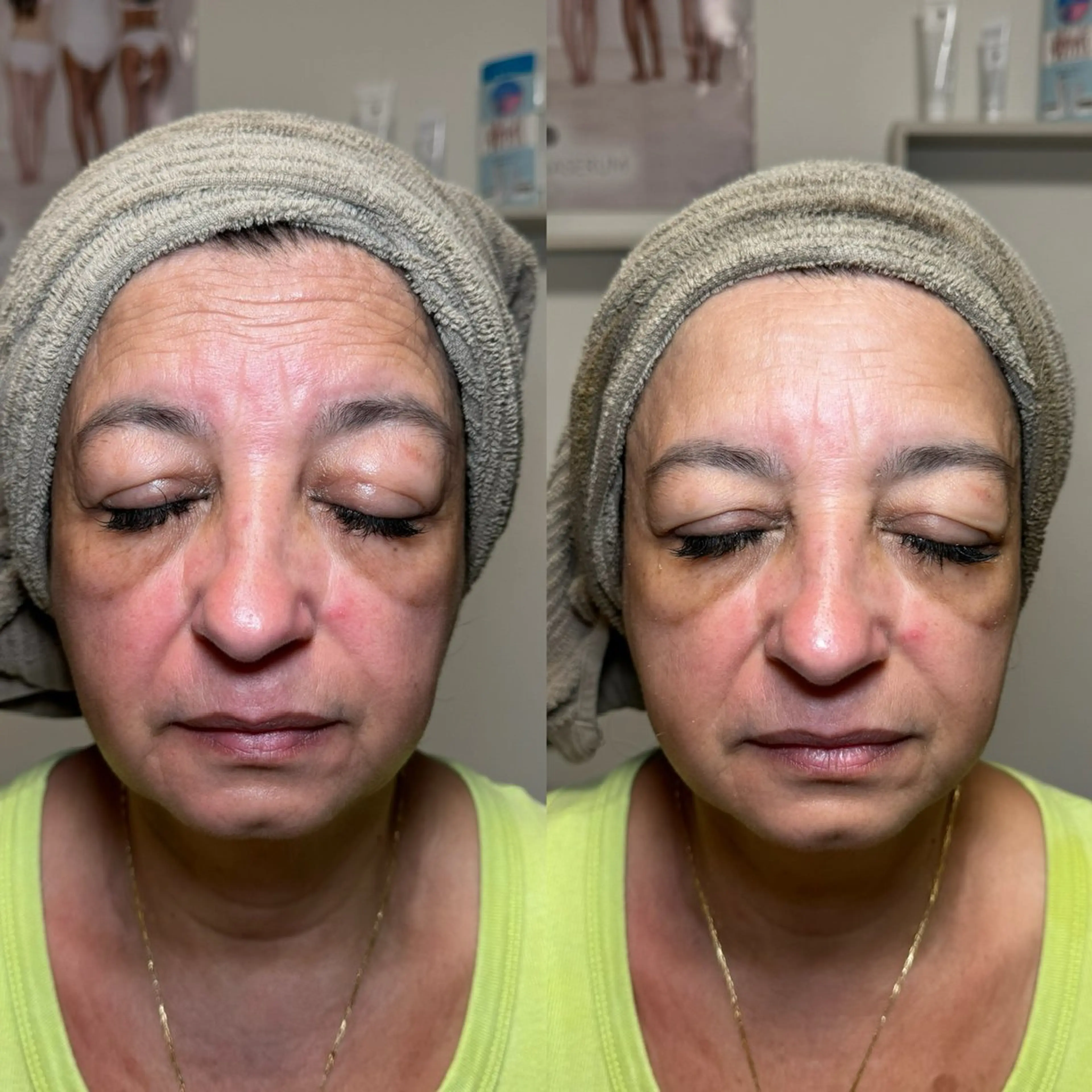 エステ Moki Amandaのエステ・リラクイメージ