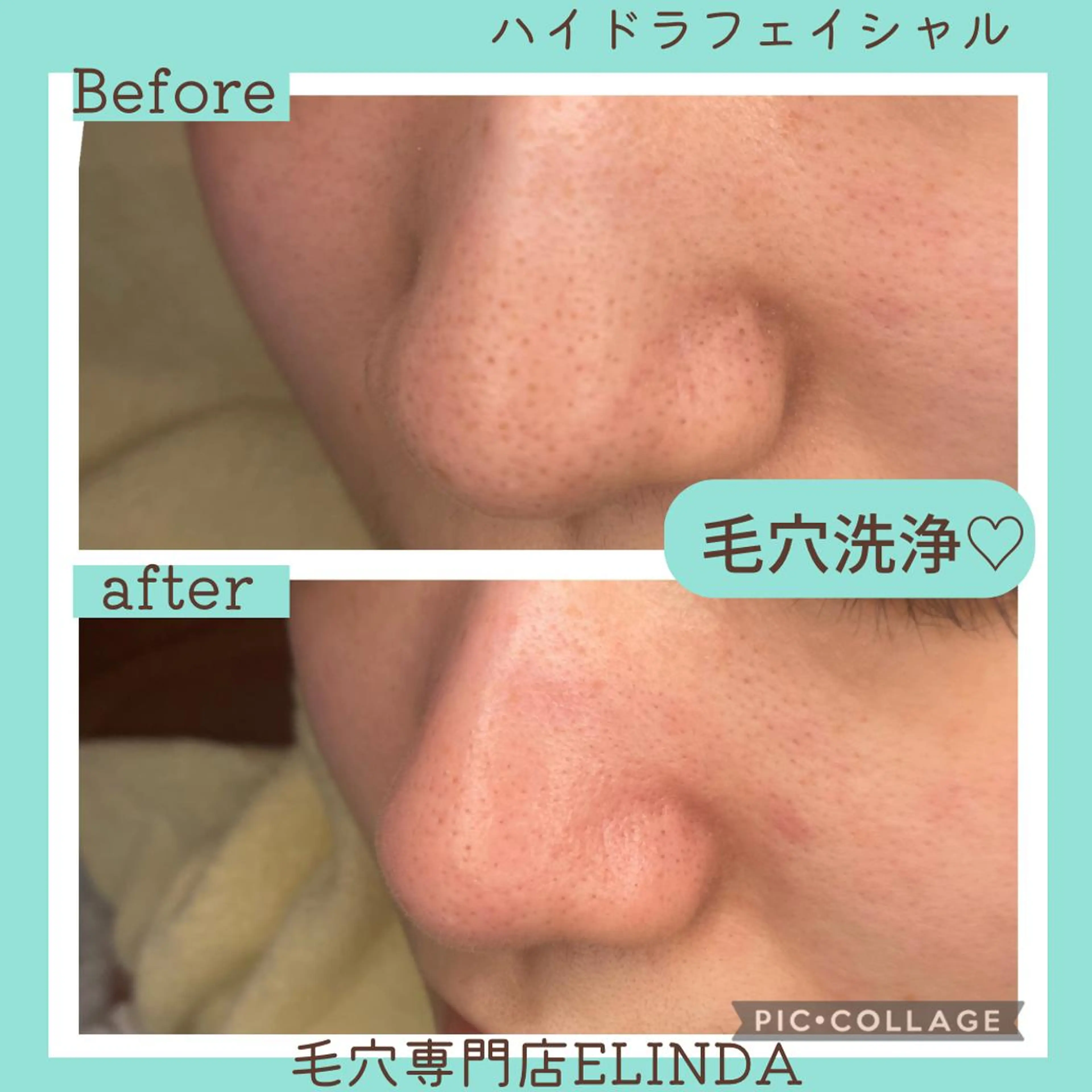 E LINDAのネイルデザイン