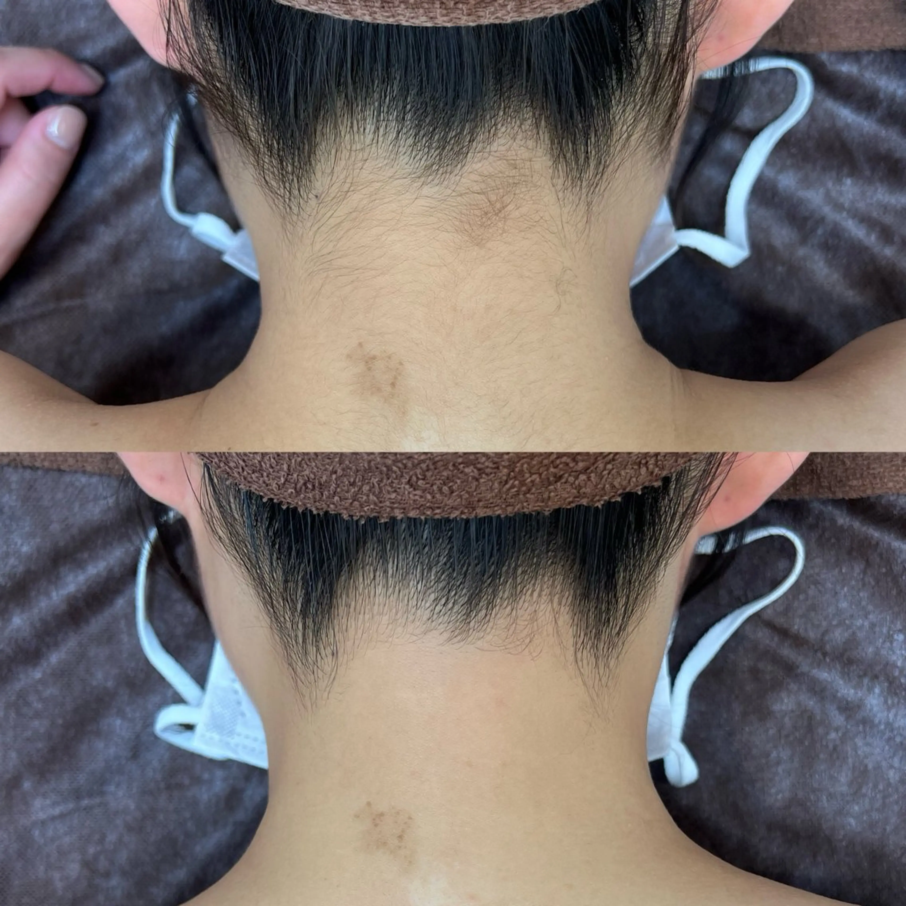 脱毛 プライベートサロン リプレイスのエステ・リラクイメージ