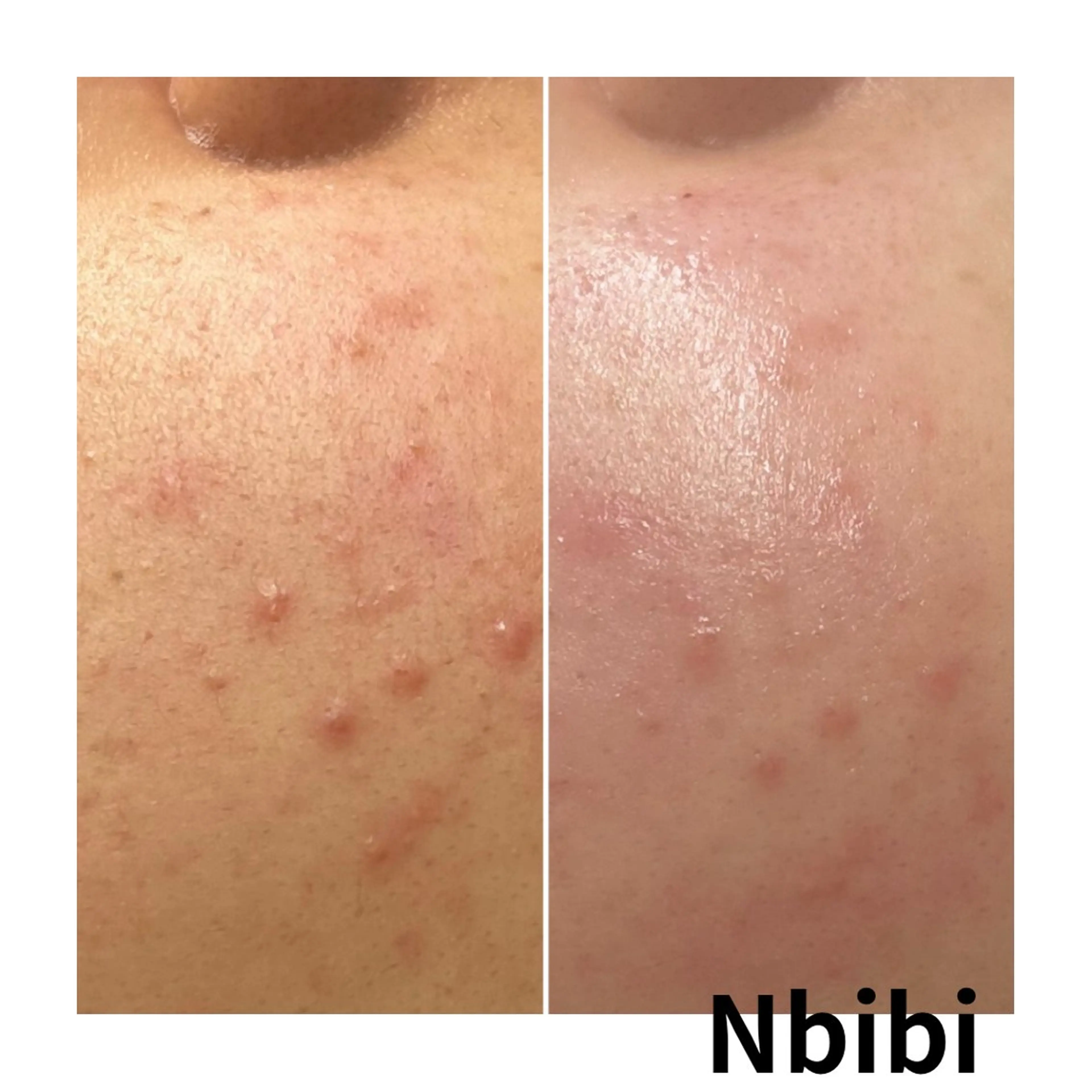 エステ 韓国🇰🇷価格 サロン_Nbibiの眉毛・アイブロウイメージ