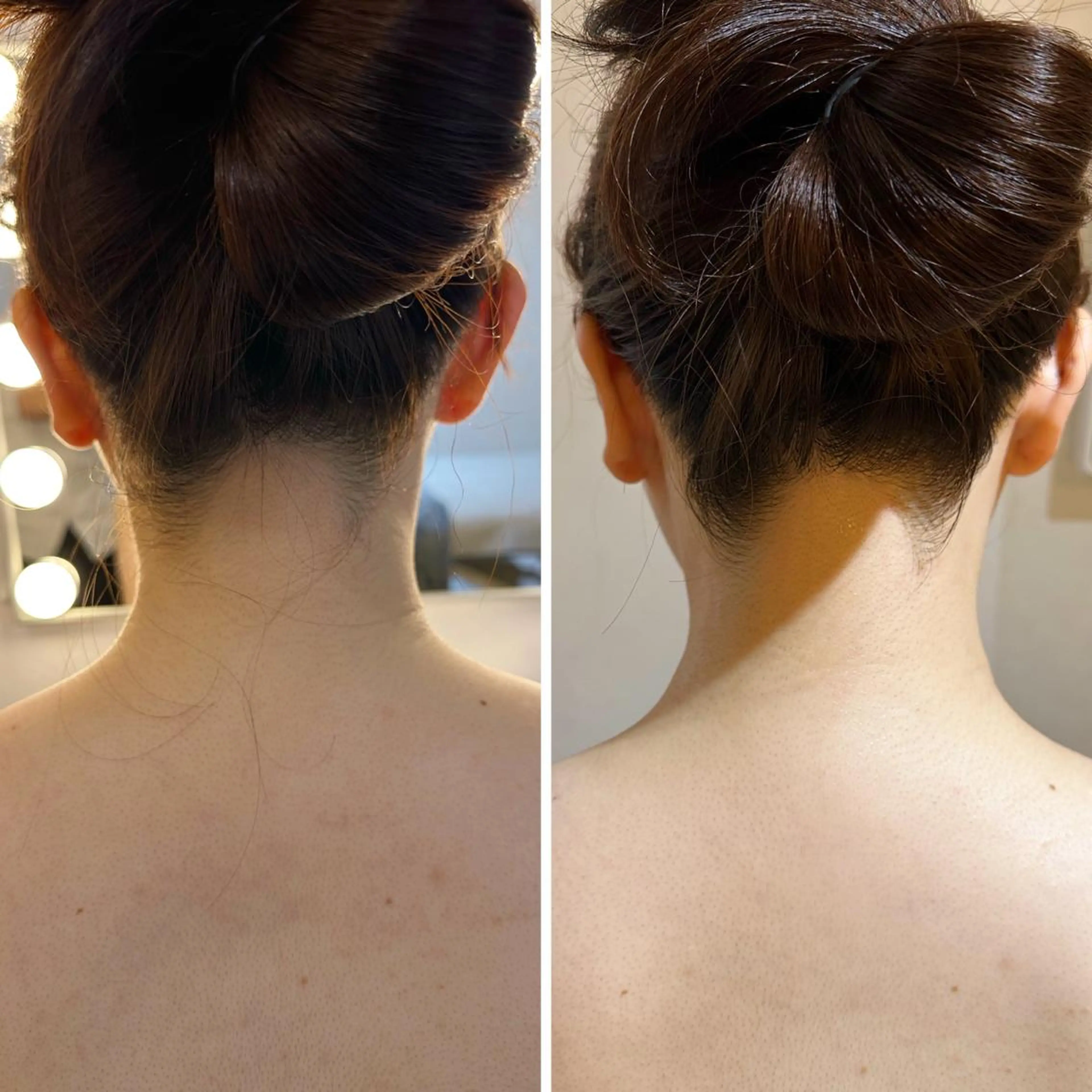 脱毛 うなじ脱毛/美肌脱毛 LABELのエステ・リラクイメージ