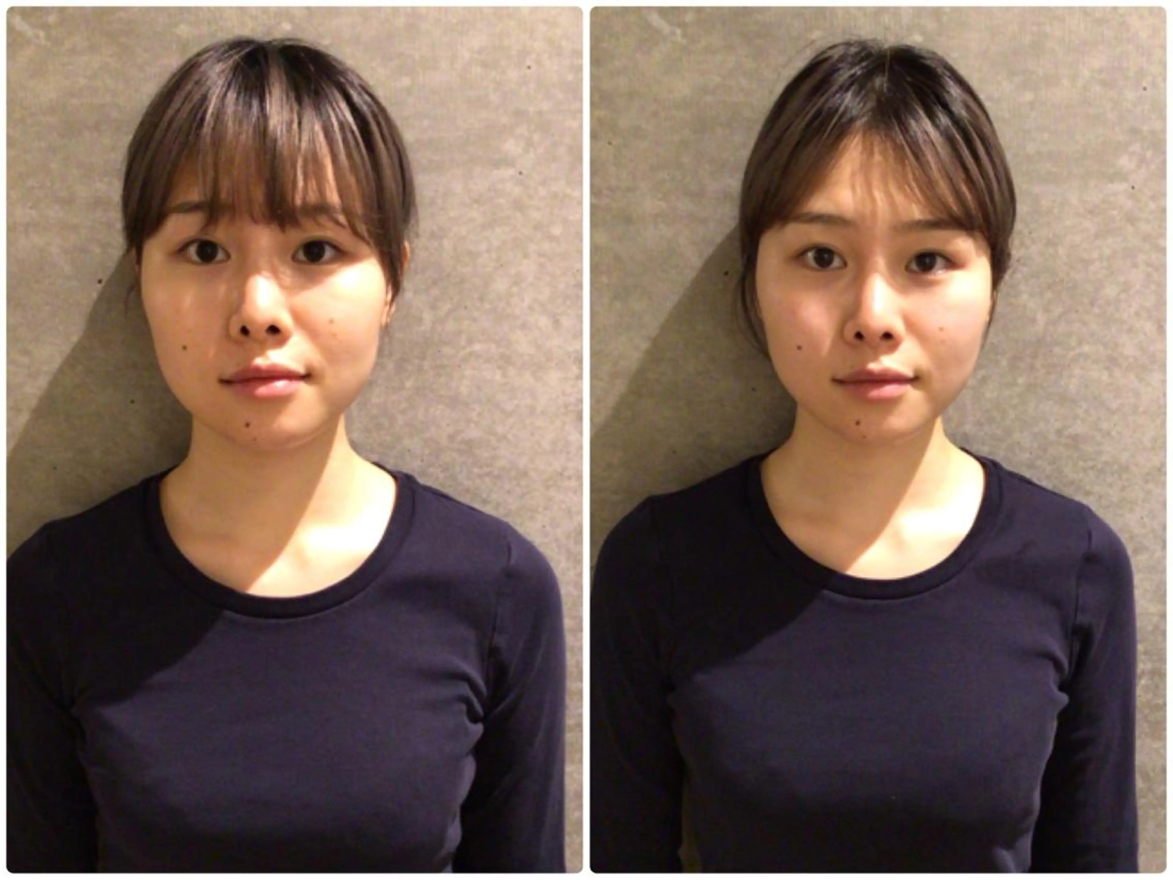 目黒/小顔/骨盤/ 美容鍼/美顔鍼/小林のエステ・リラクイメージ