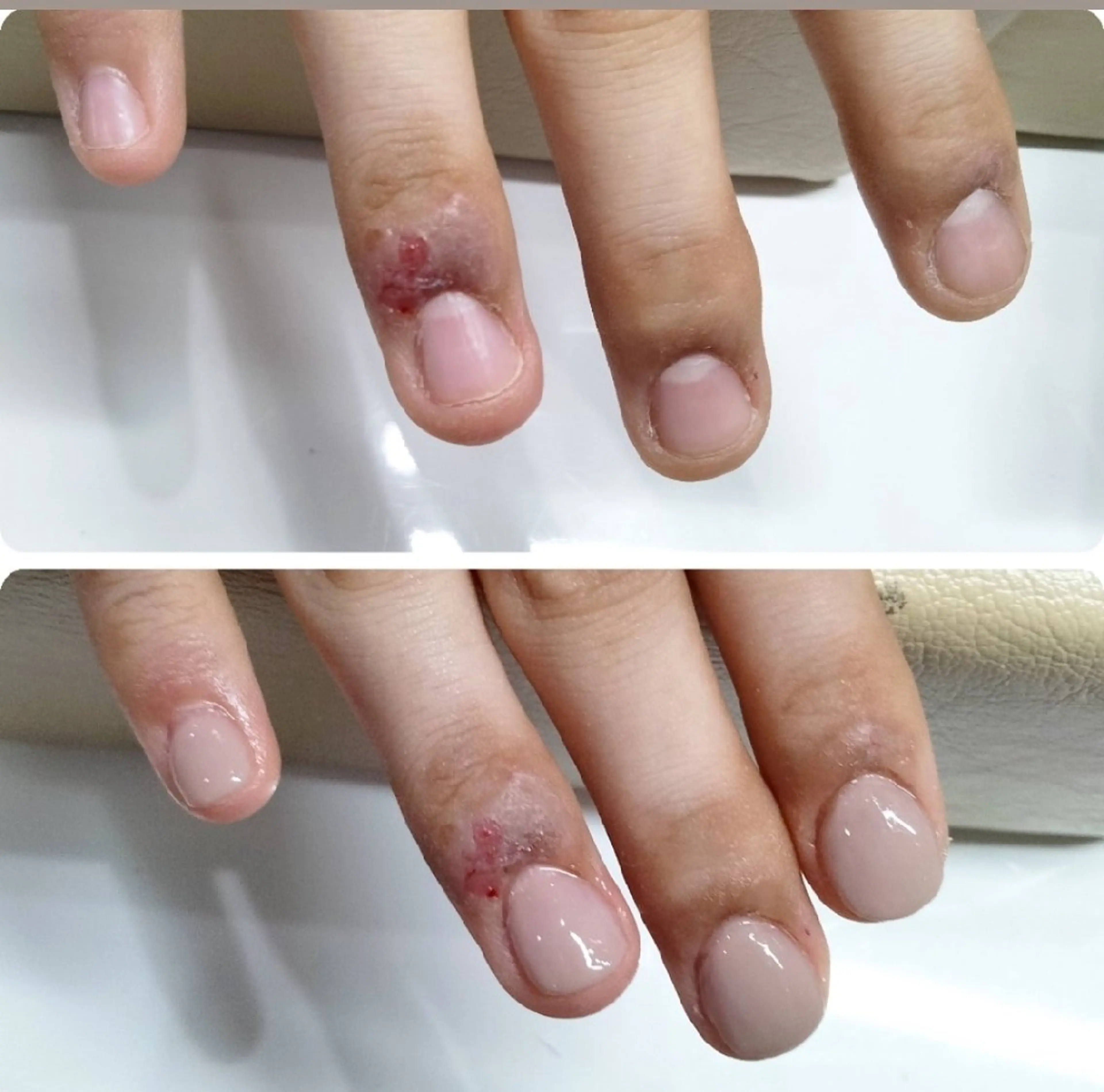 ネイル ネイルサロン アリュームのネイルデザイン