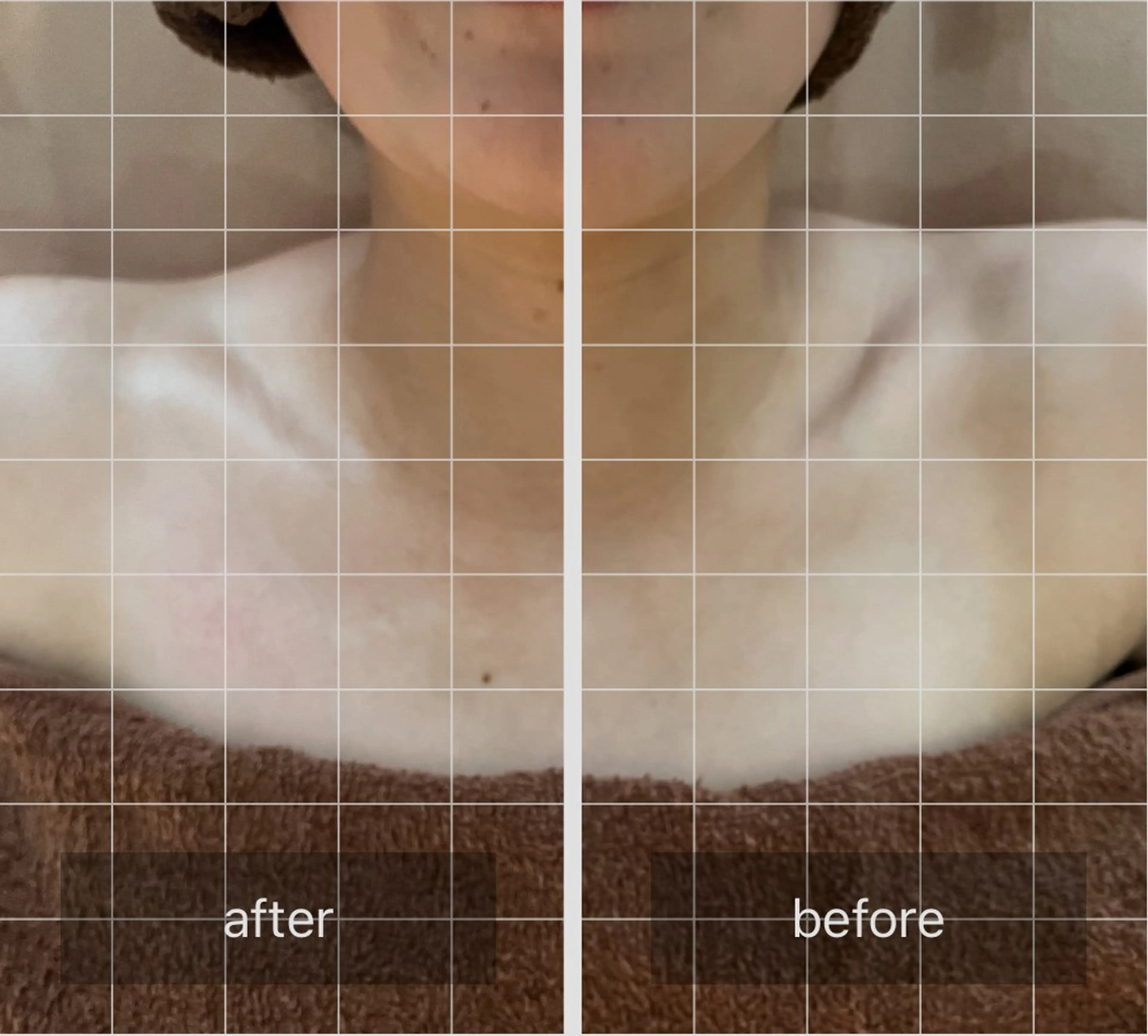 心斎橋痩身ダイエット 韓国.美容鍼.小顔のエステ・リラクイメージ