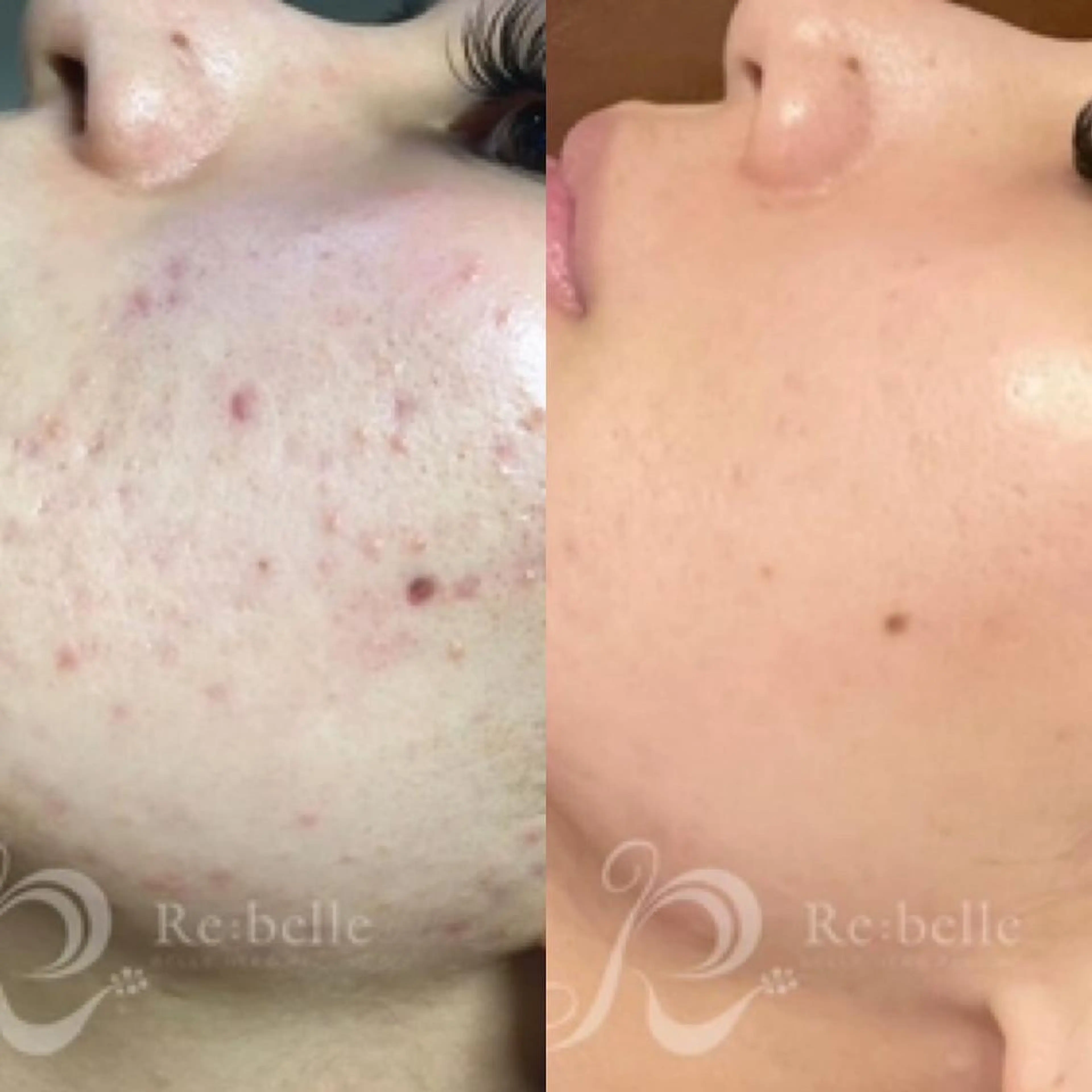 ank アンクのマツエク・マツパデザイン