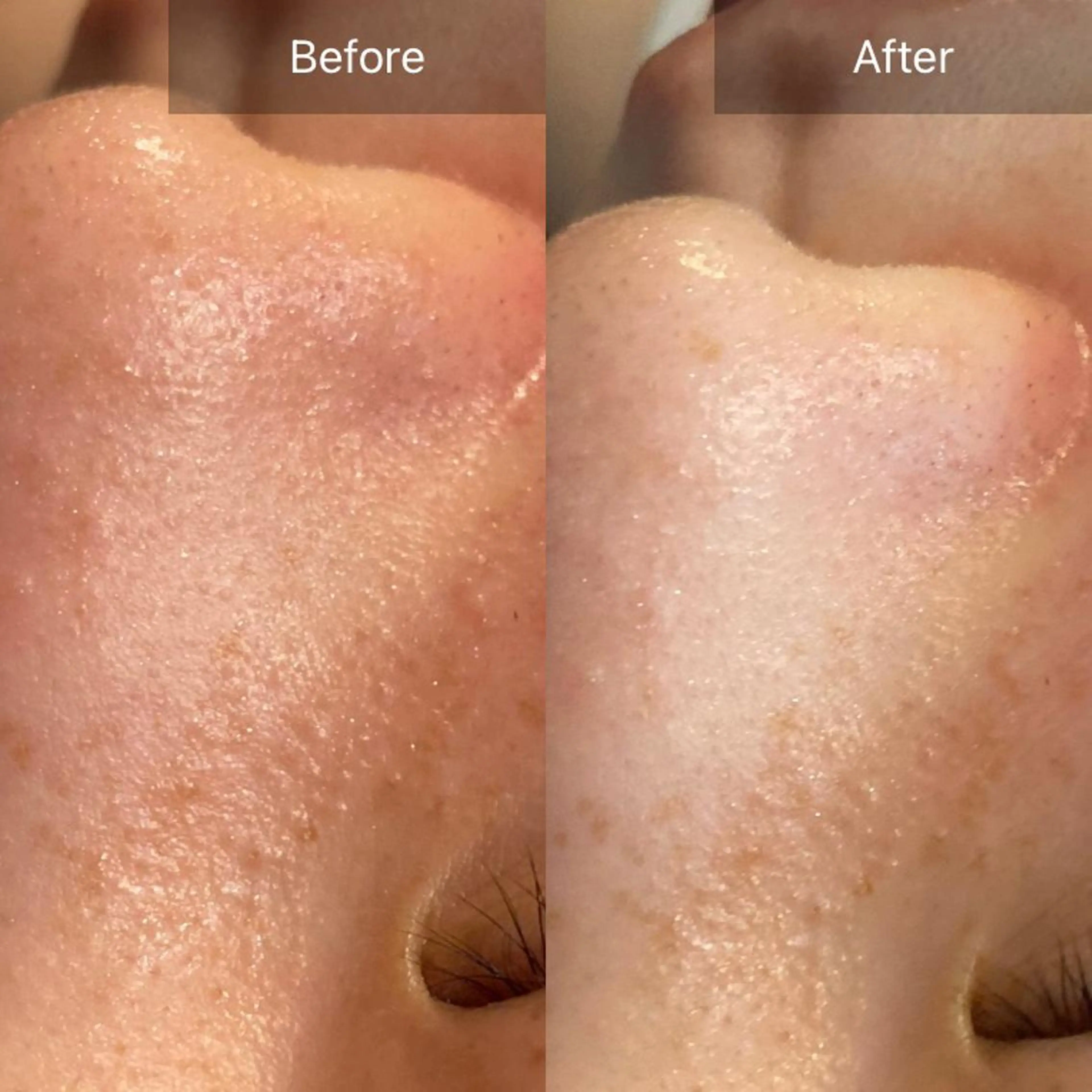 Mandarin Orange所属・毛穴から始める肌メン テマンダリンオレンジのエステ・リラクイメージ