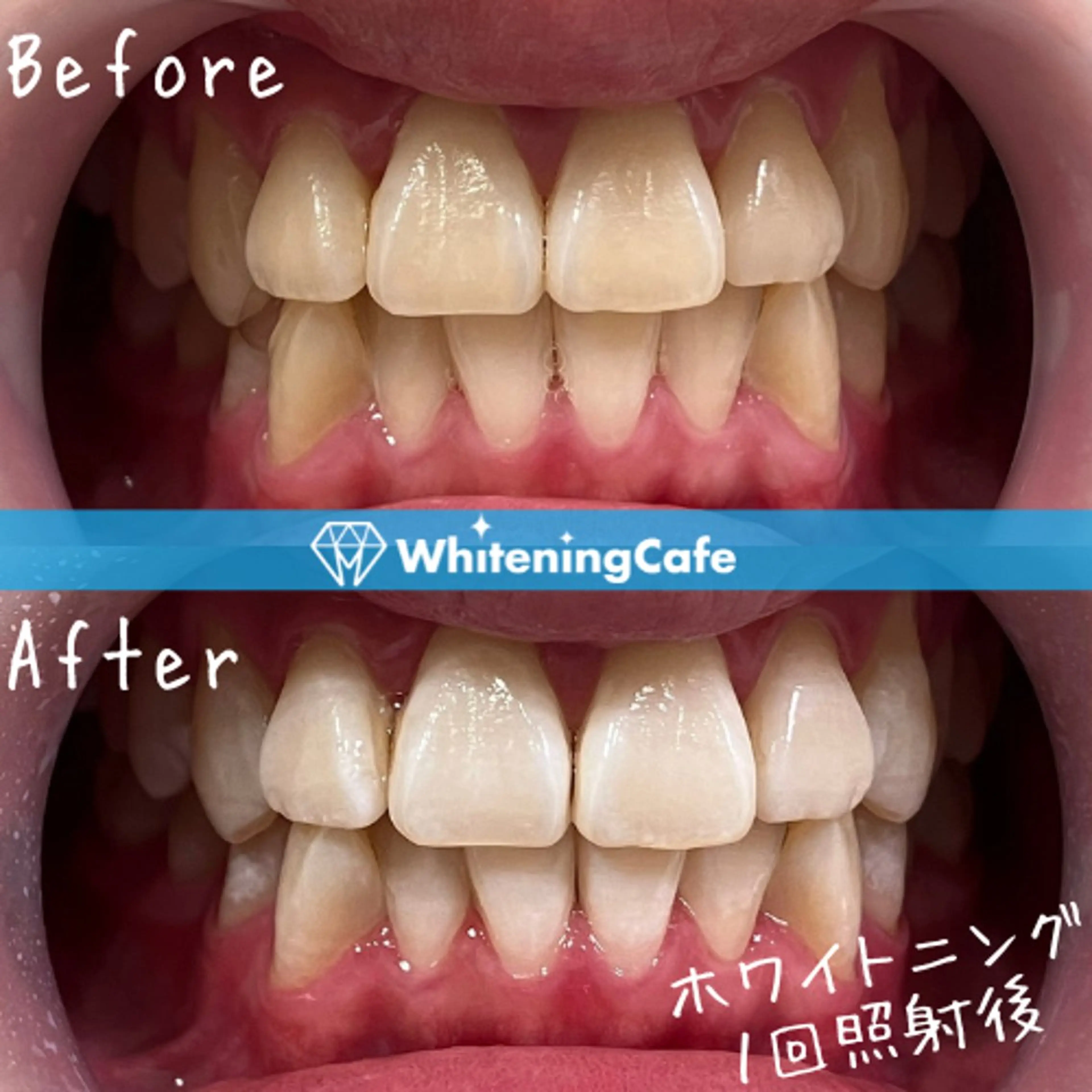 ホワイトニングカフェ 徳島沖浜店のエステ・リラクイメージ