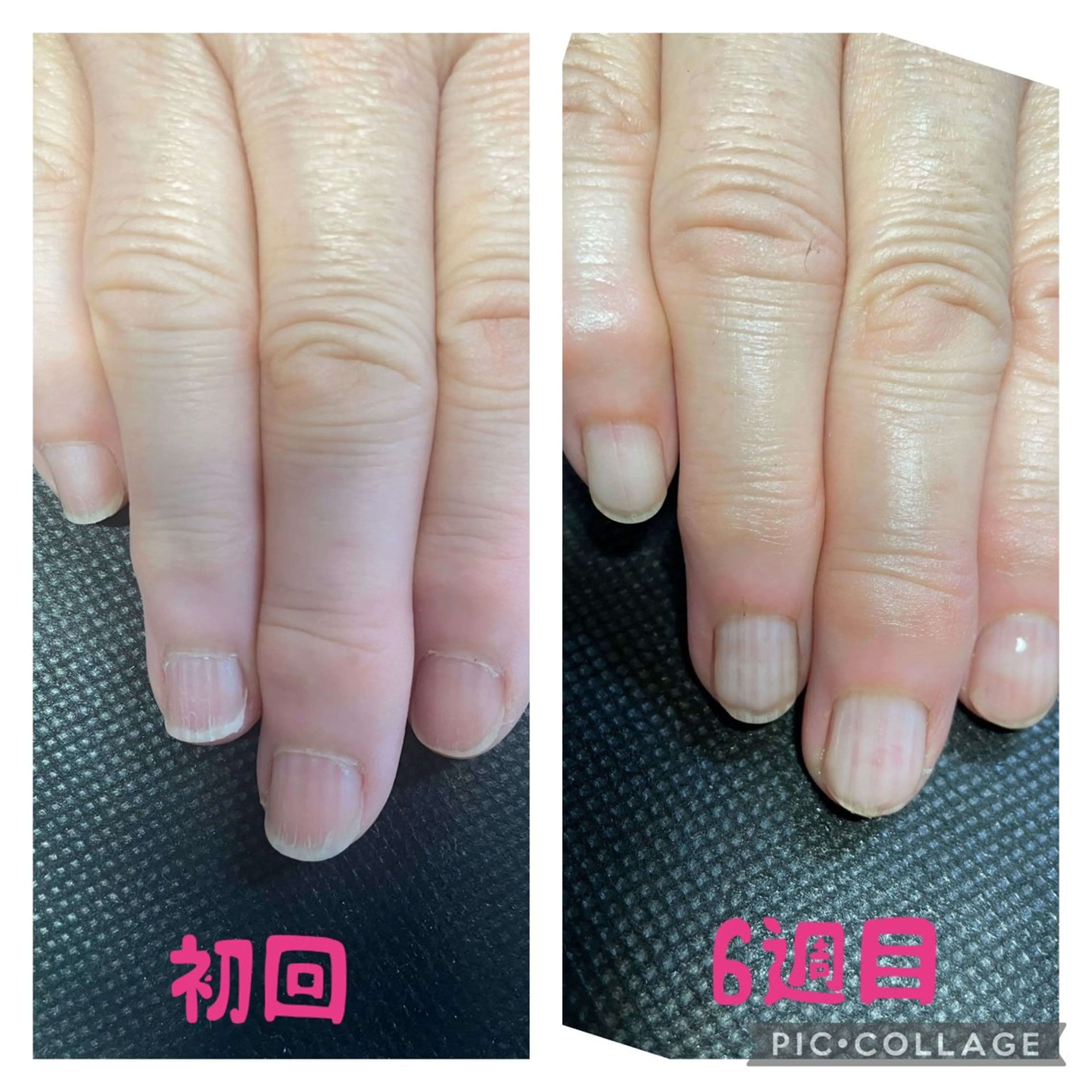 ネイル ジェルネイル 荒井 恵のネイルデザイン