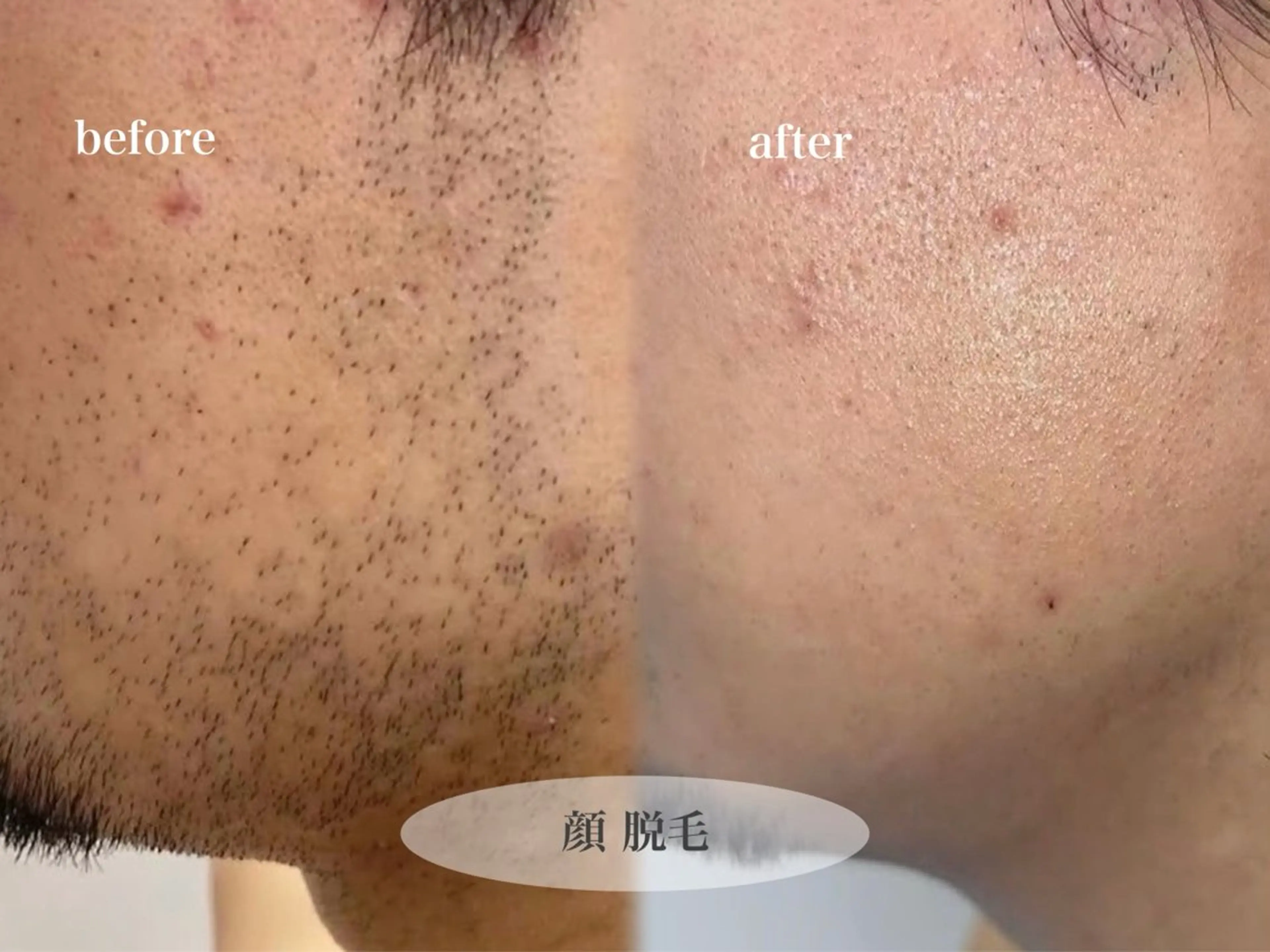 脱毛 金田 真菜美のエステ・リラクイメージ