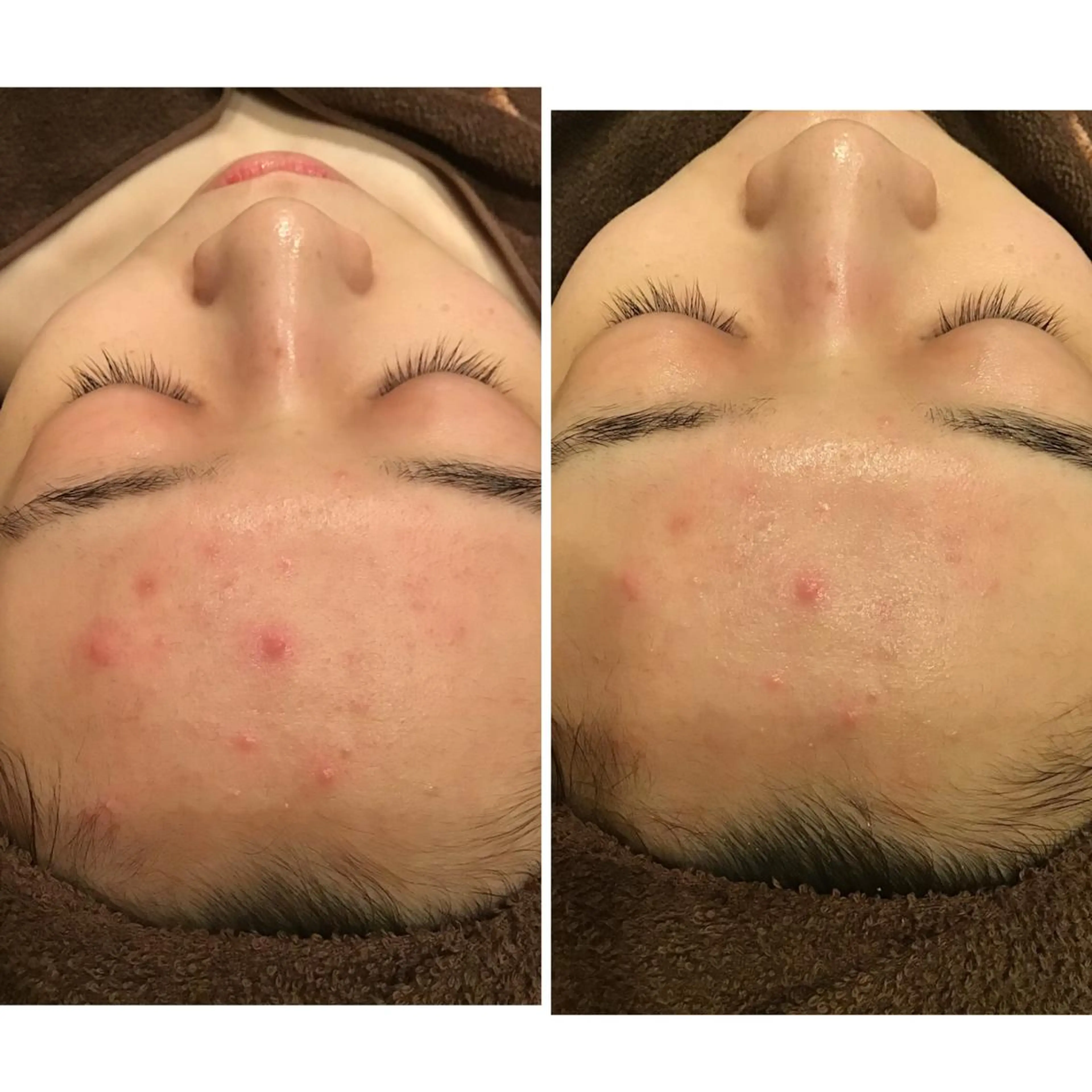 エステ リラク レイビス八戸店 野口のエステ・リラクイメージ