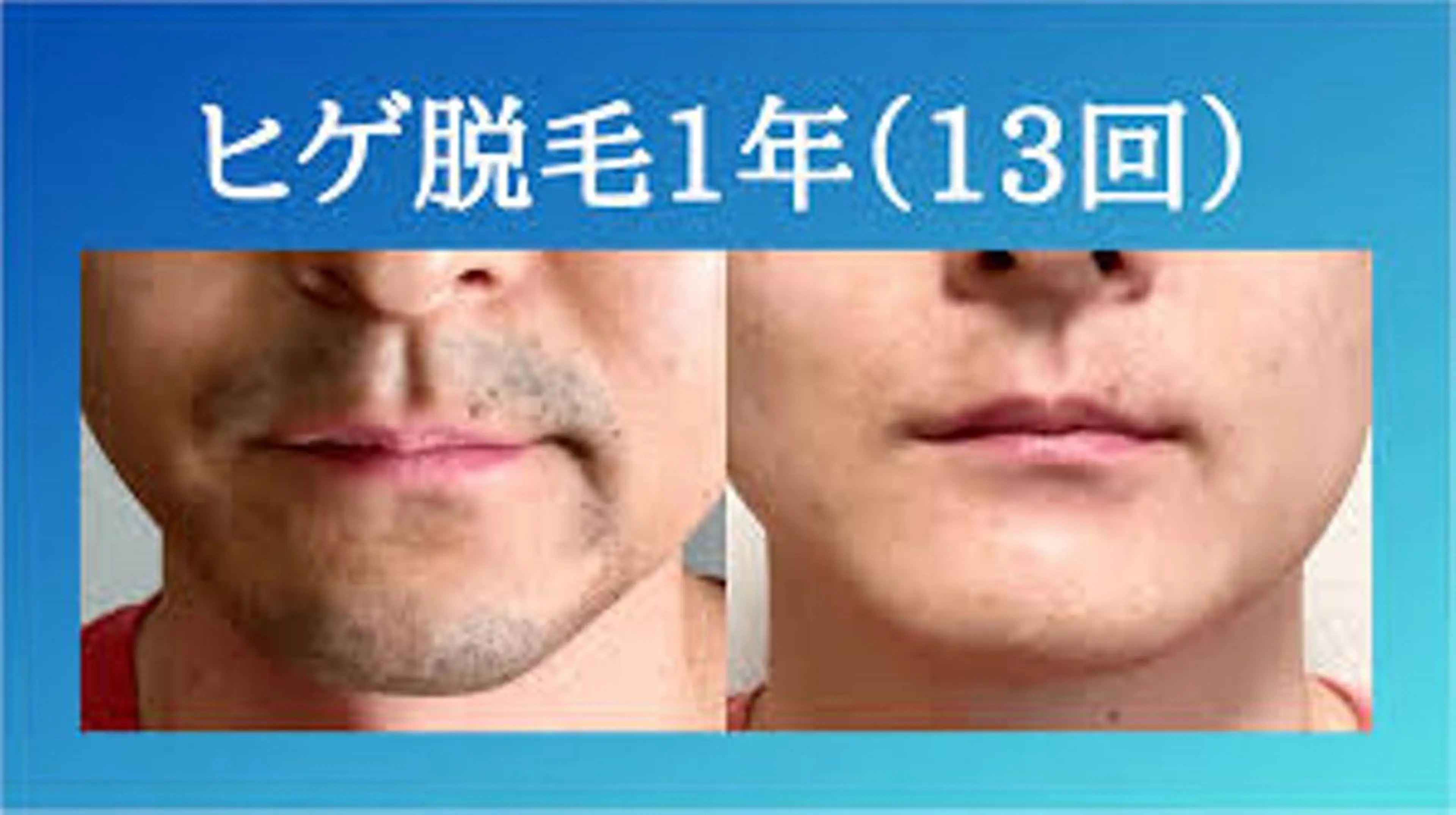 脱毛 beauty salon epのエステ・リラクイメージ