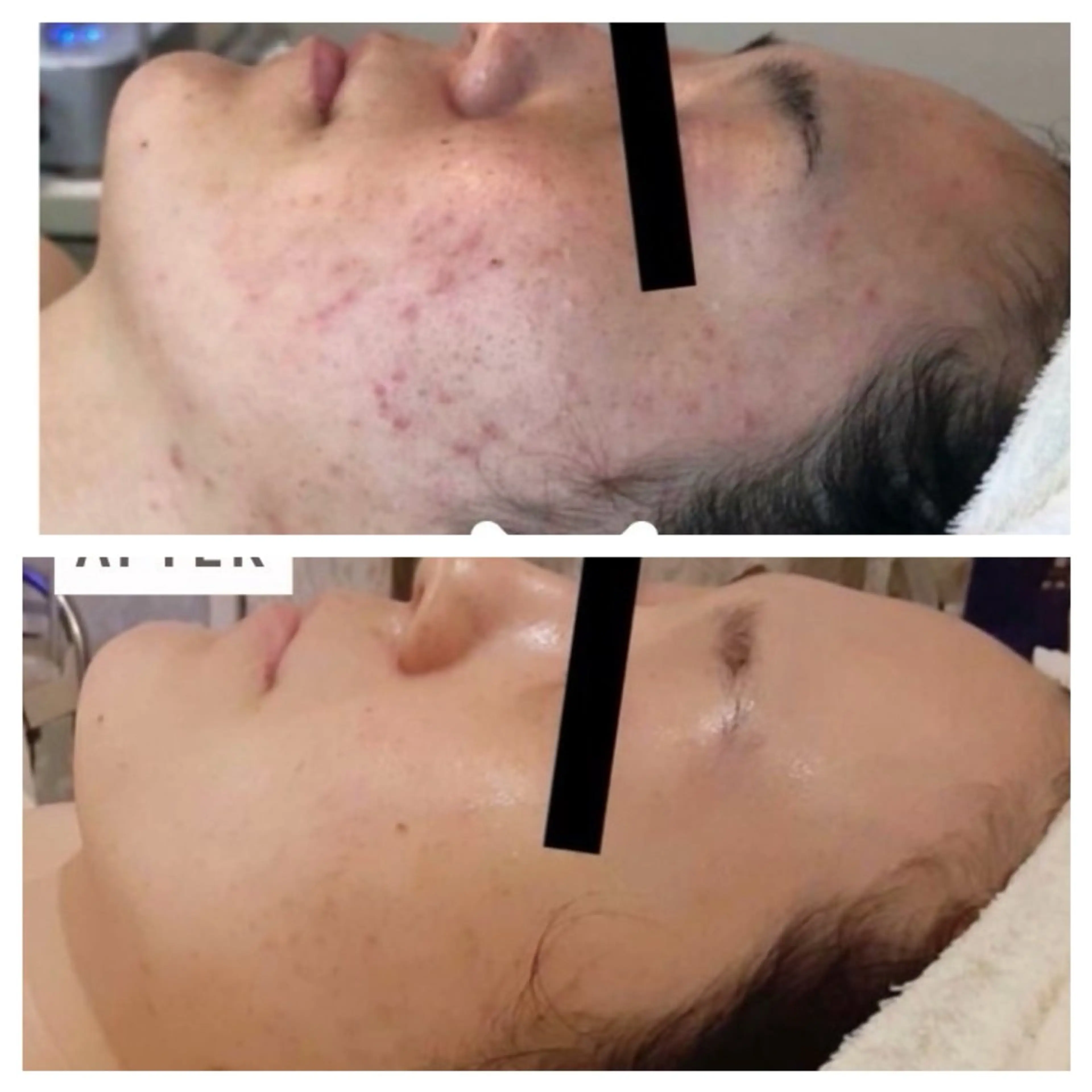 肌質改善エステ RISMINのエステ・リラクイメージ