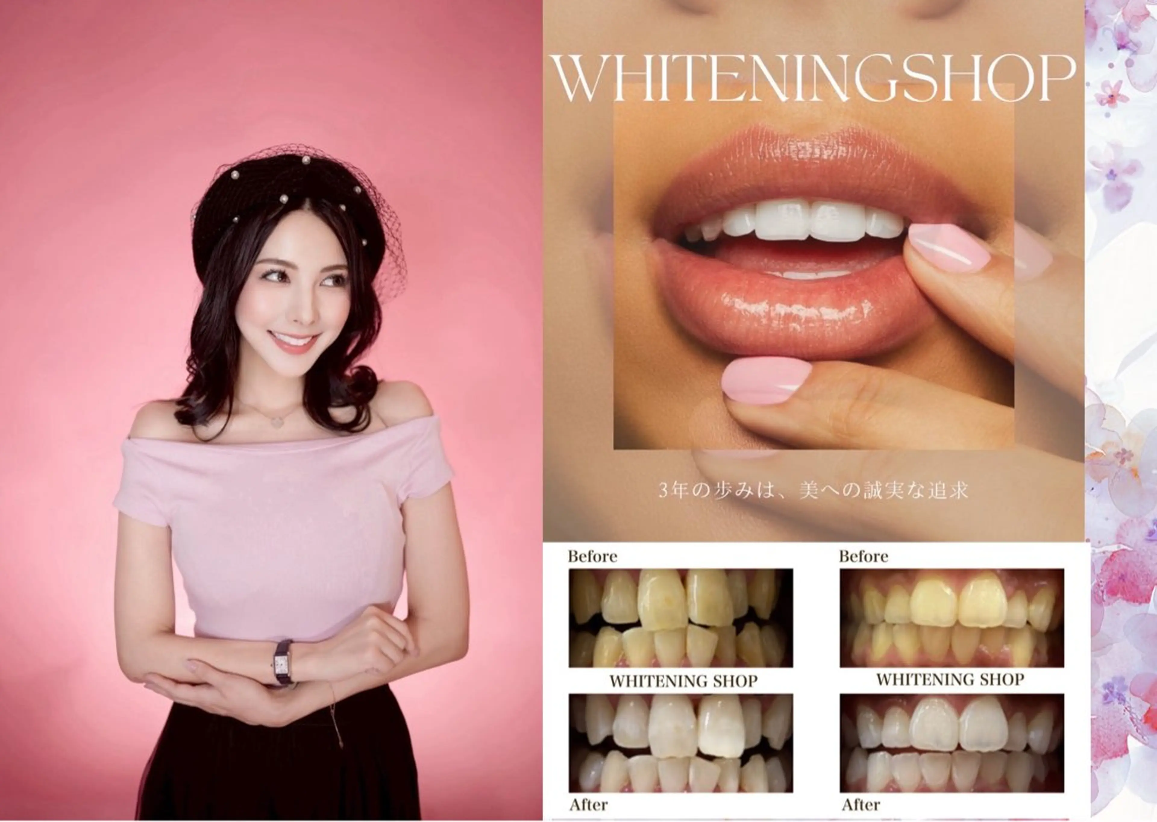 ホワイトニングショップ静岡葵区店所属・ホワイトニング ショップ葵区静岡駅店のその他イメージ