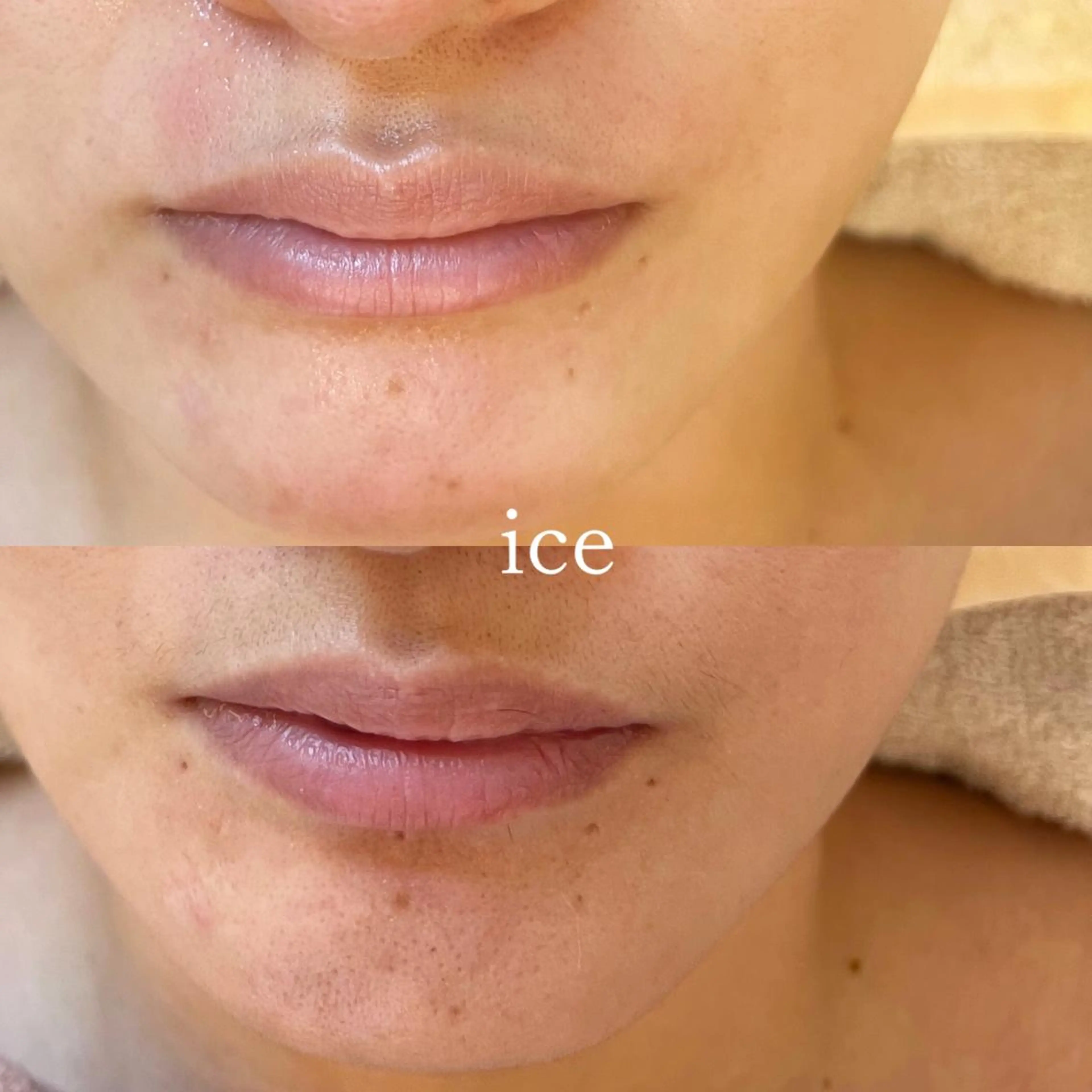 アイブロウ 眉毛ワックス脱毛 エステ ワックス脱毛専門店 ICE  池袋の眉毛・アイブロウイメージ