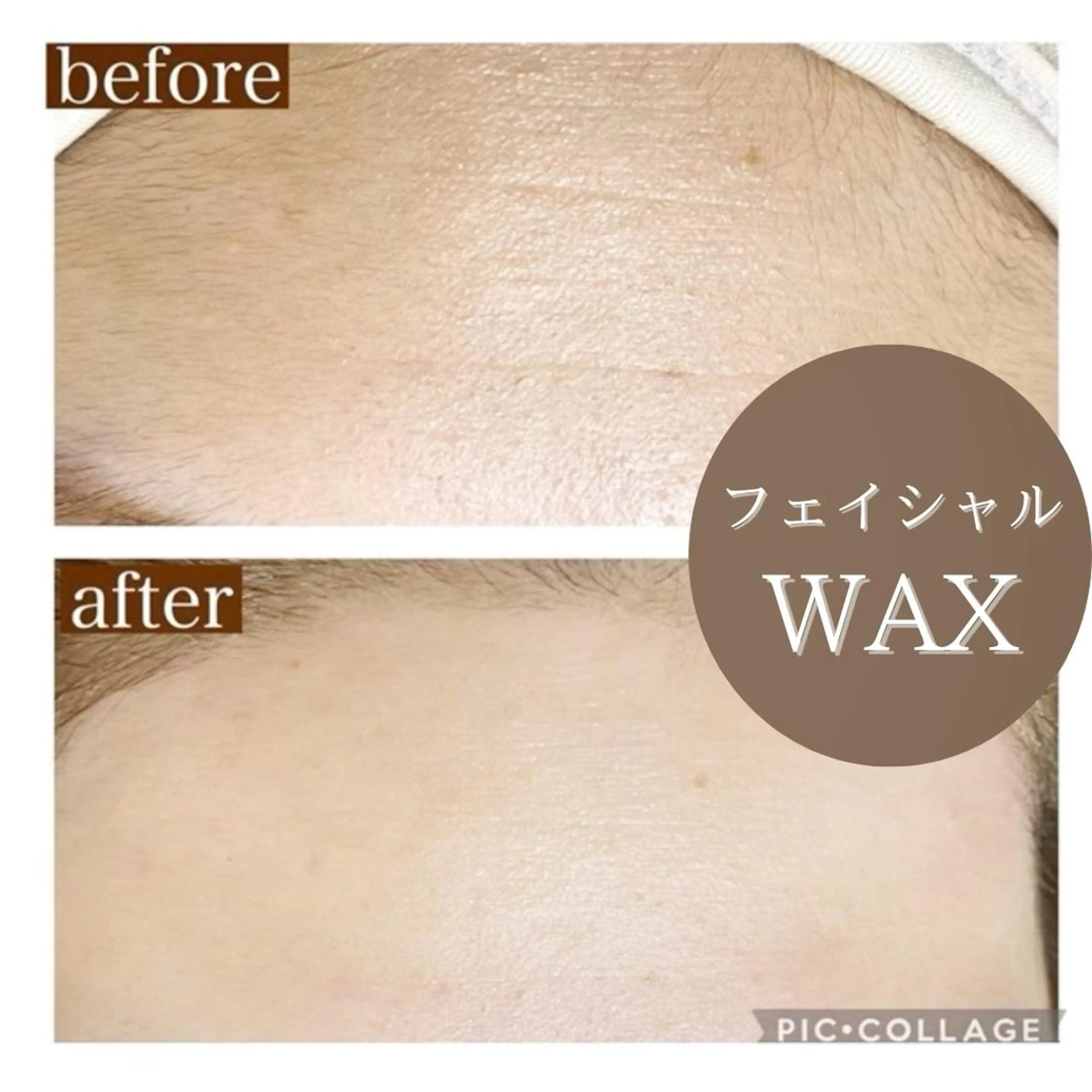 【産毛・くすみさよなら】　　　　　　　　　　素肌美人コースの写真