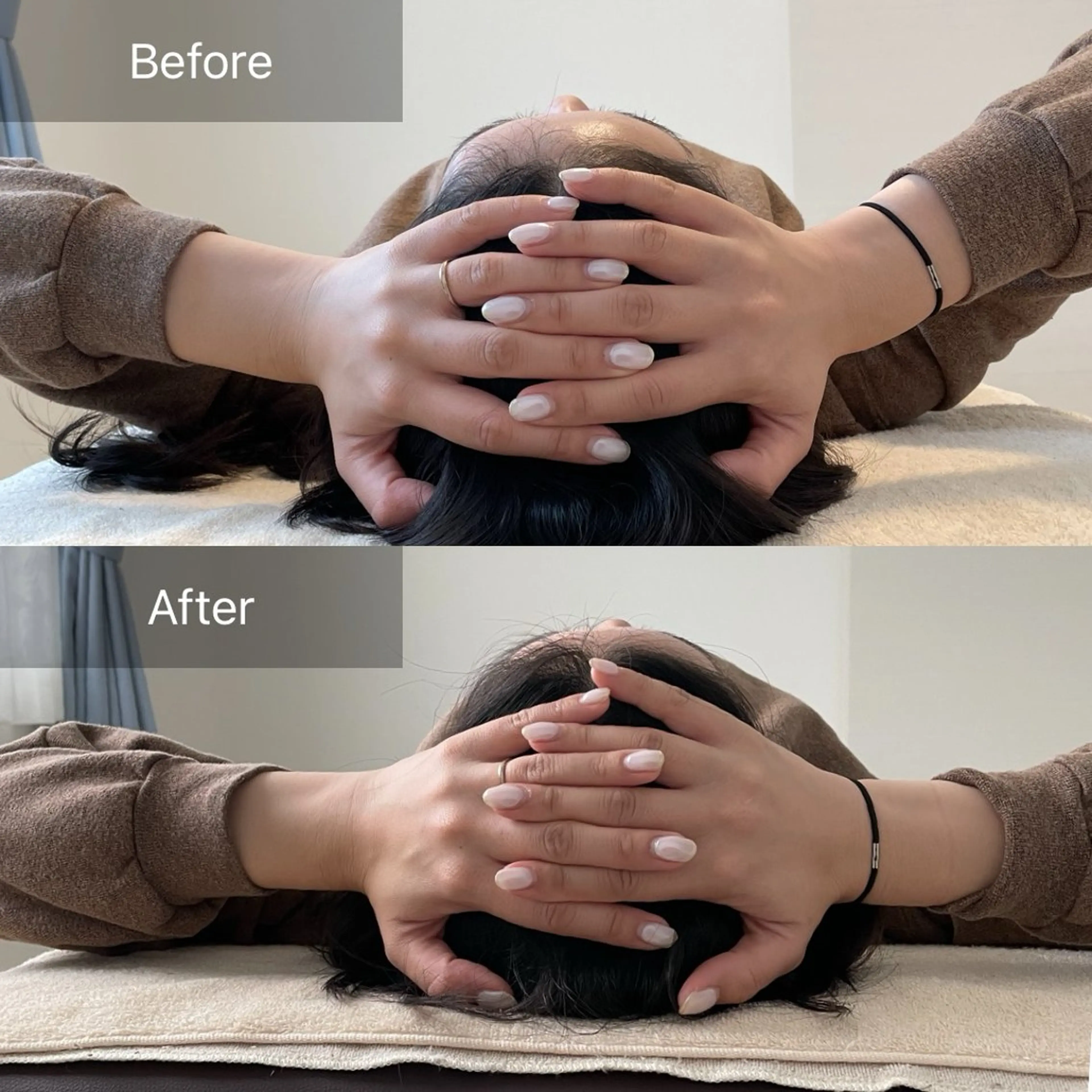 頭蓋骨・小顔矯正(初回)の写真