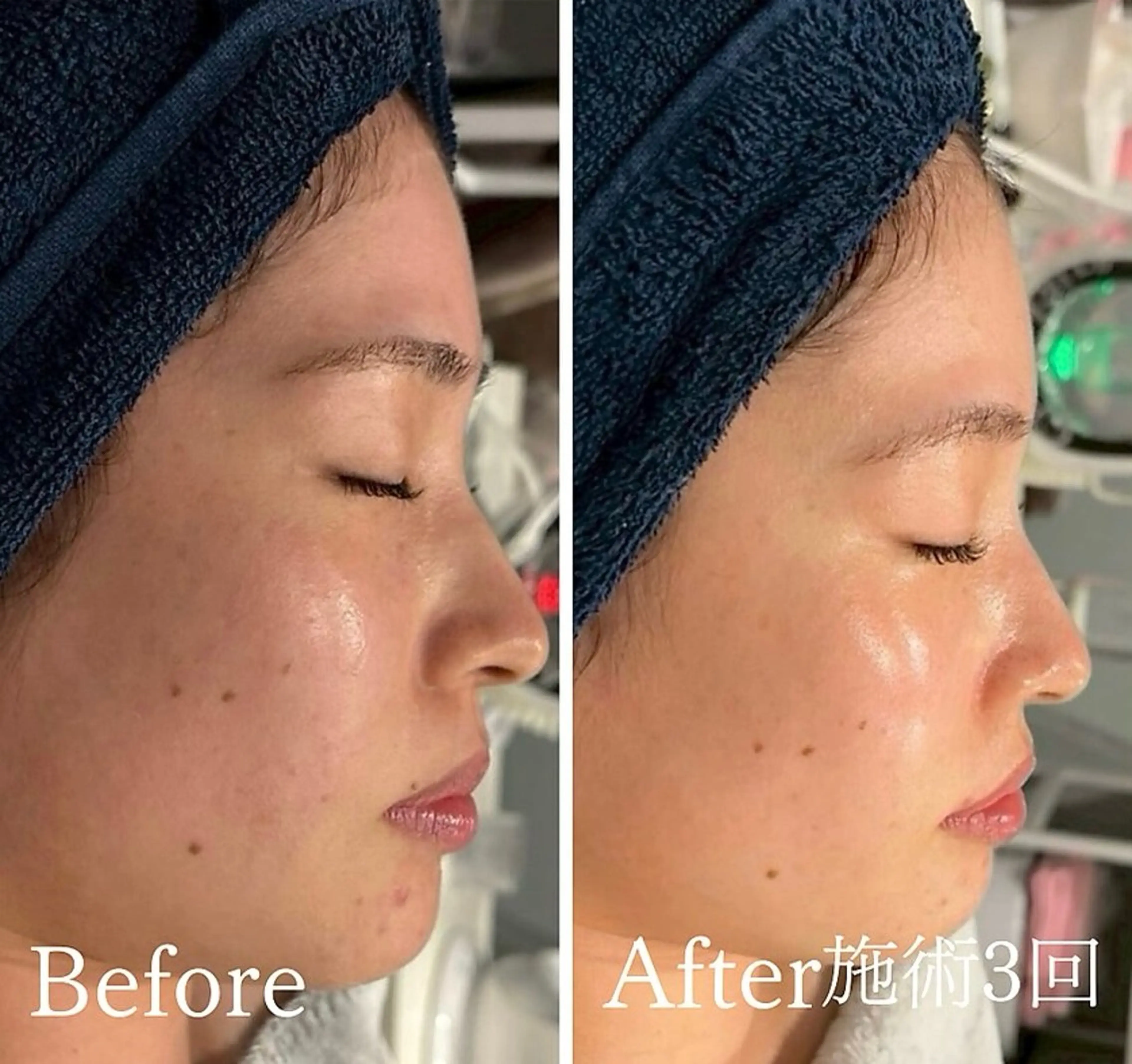 アンド ミルルのエステ・リラクイメージ