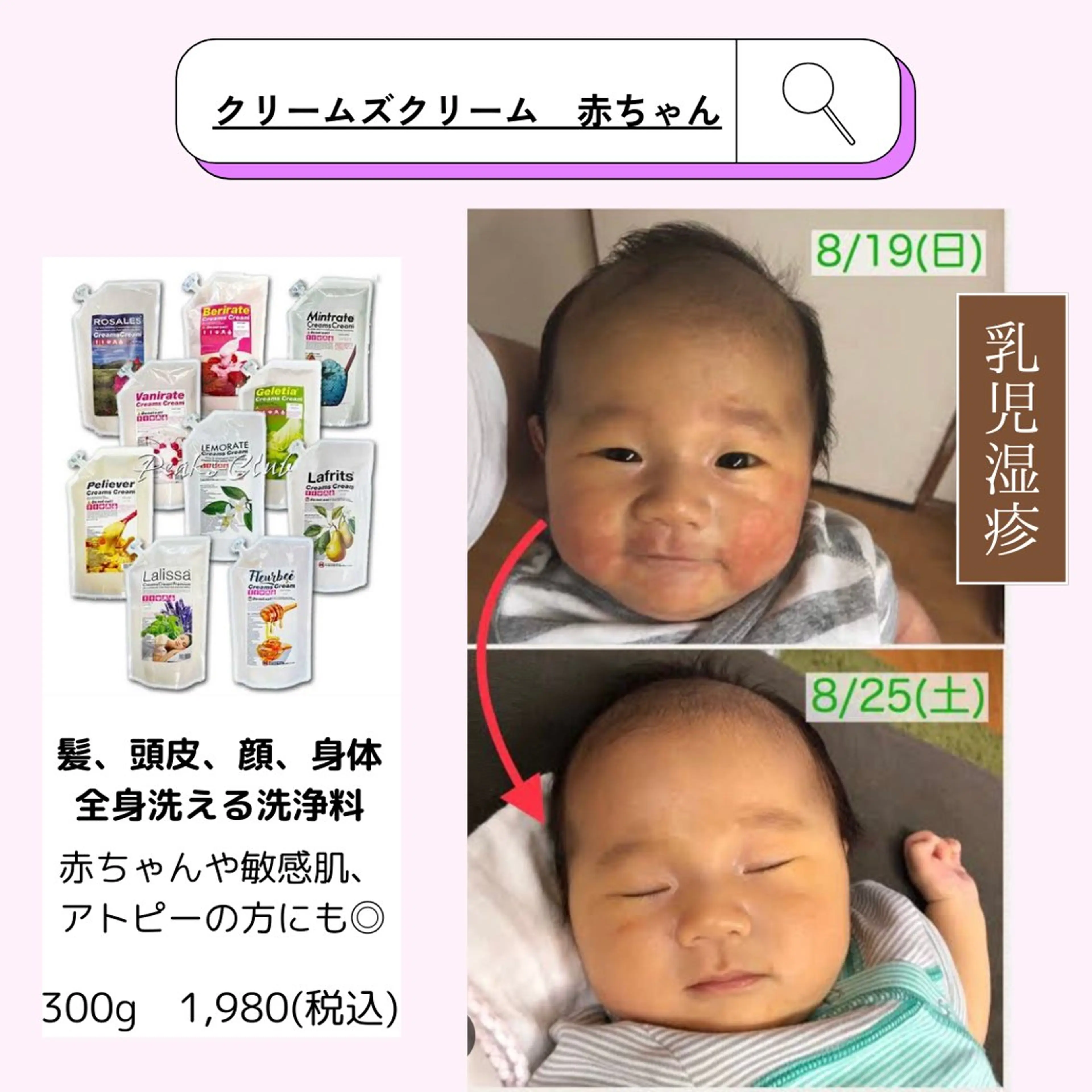 leolo武蔵浦和 肌質改善&脱毛のエステ・リラクイメージ