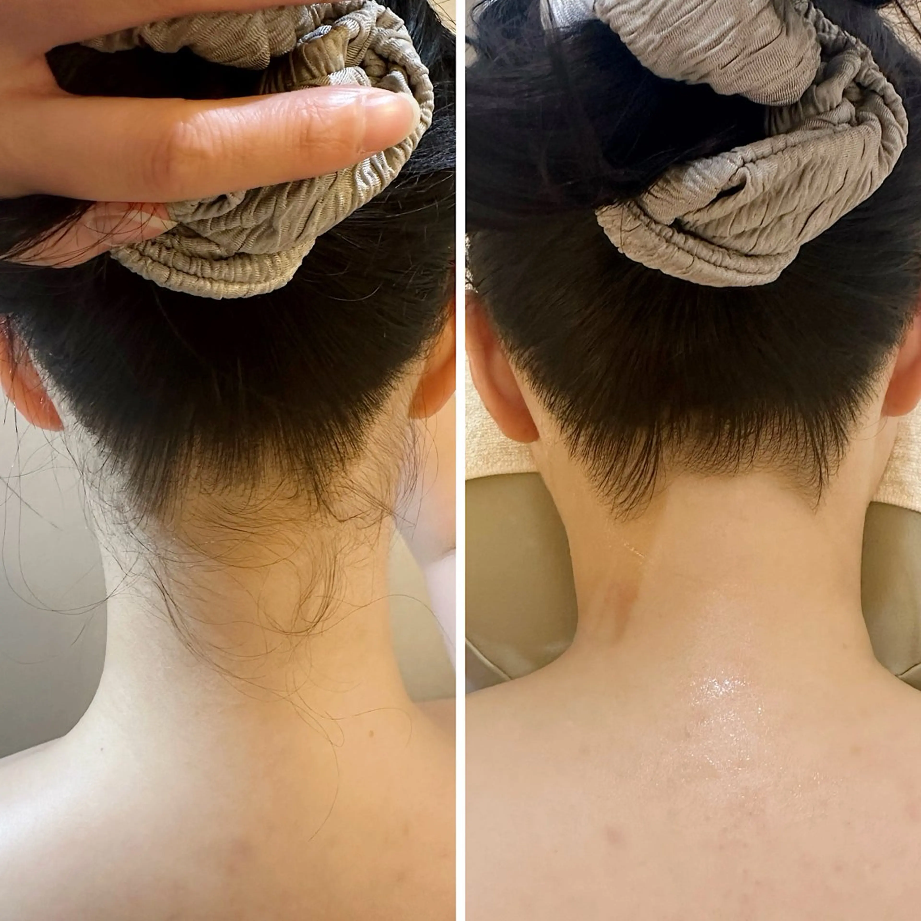 脱毛 うなじ脱毛/美肌脱毛 LABELのエステ・リラクイメージ