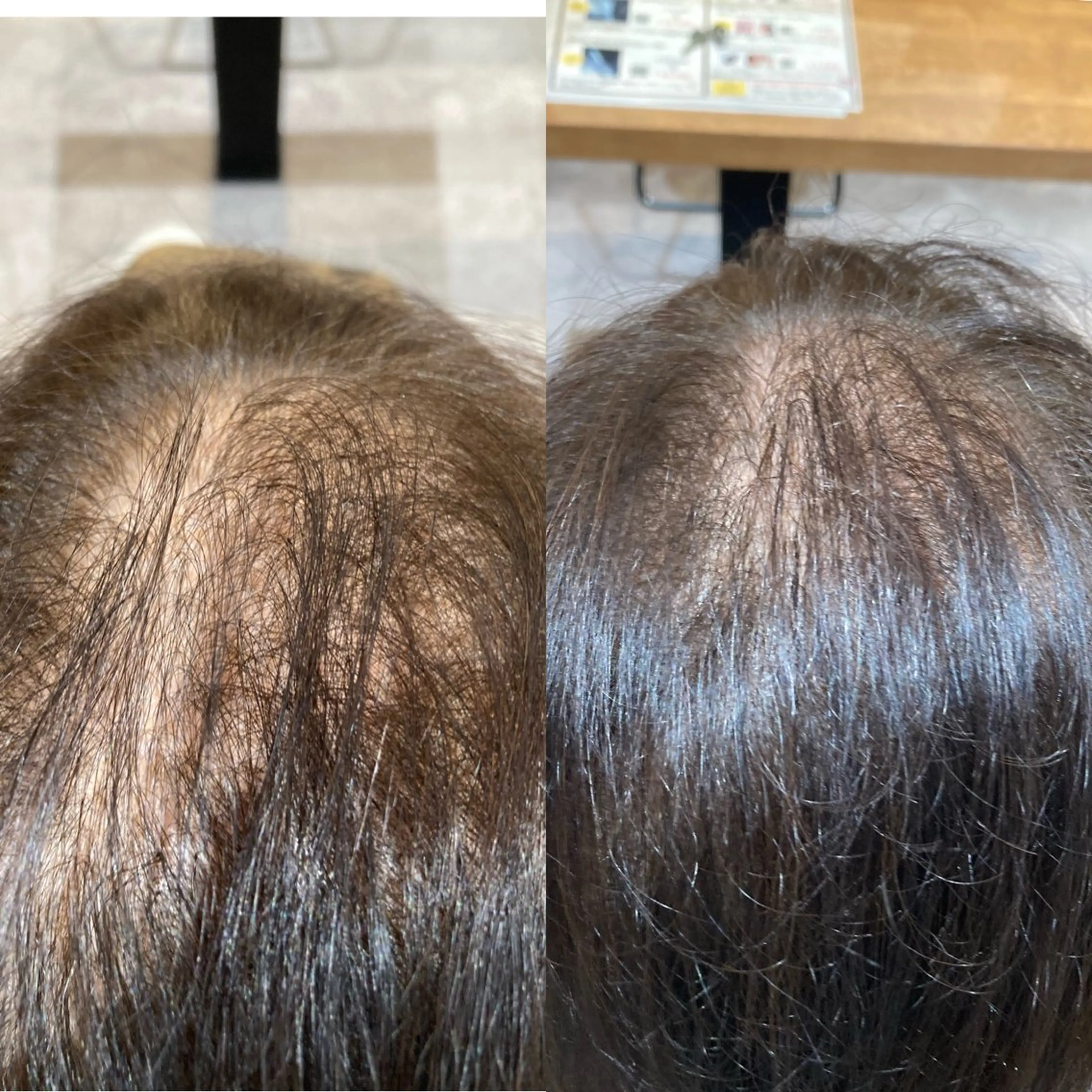 エアリーエクステ（ヘア増毛）　100本​〜​の写真