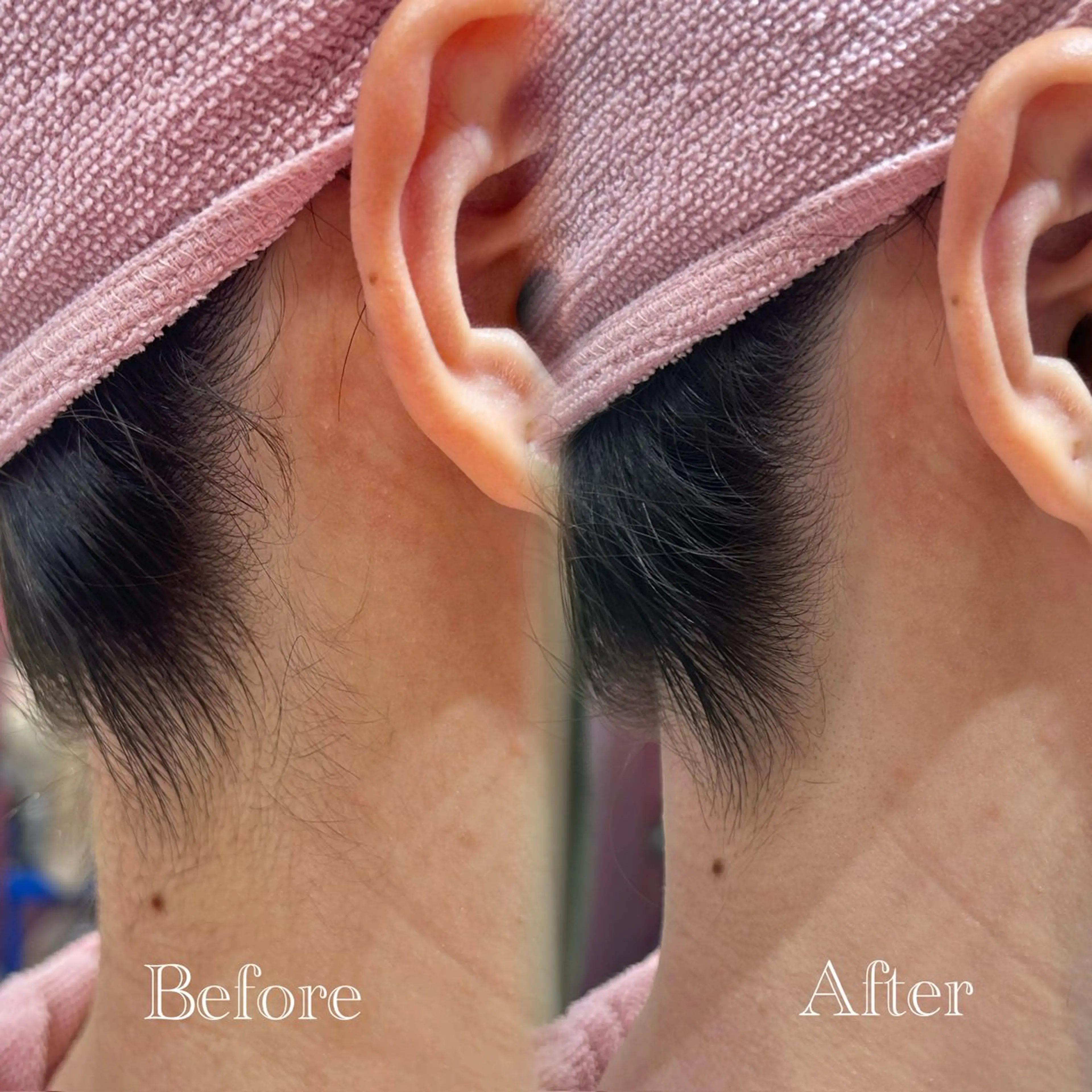 その他 🫧美しい素肌へ🫧 今成柚乃のその他イメージ