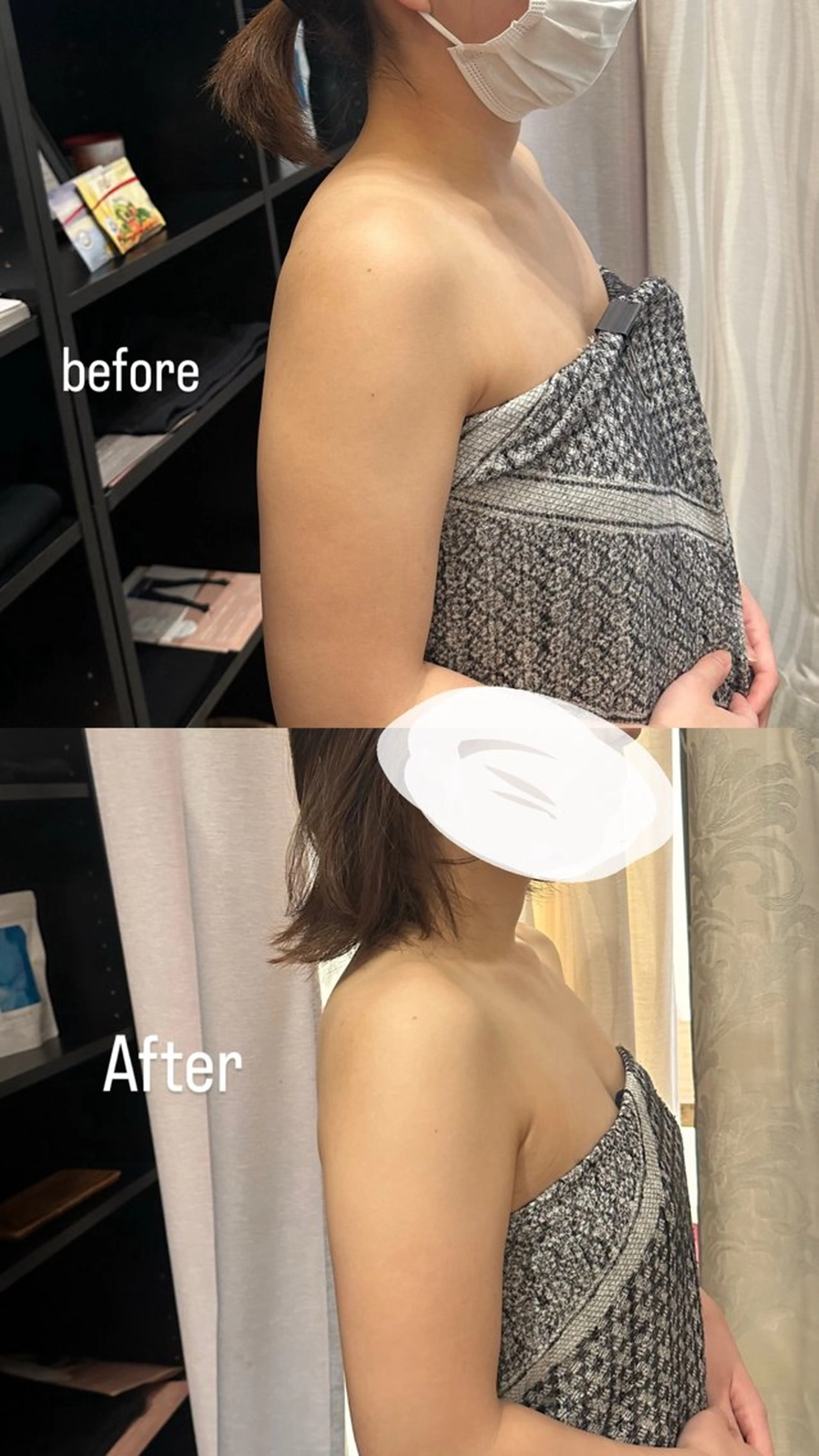 エステ 浮腫|肩こり|張り 日々の疲れを解消★のエステ・リラクイメージ