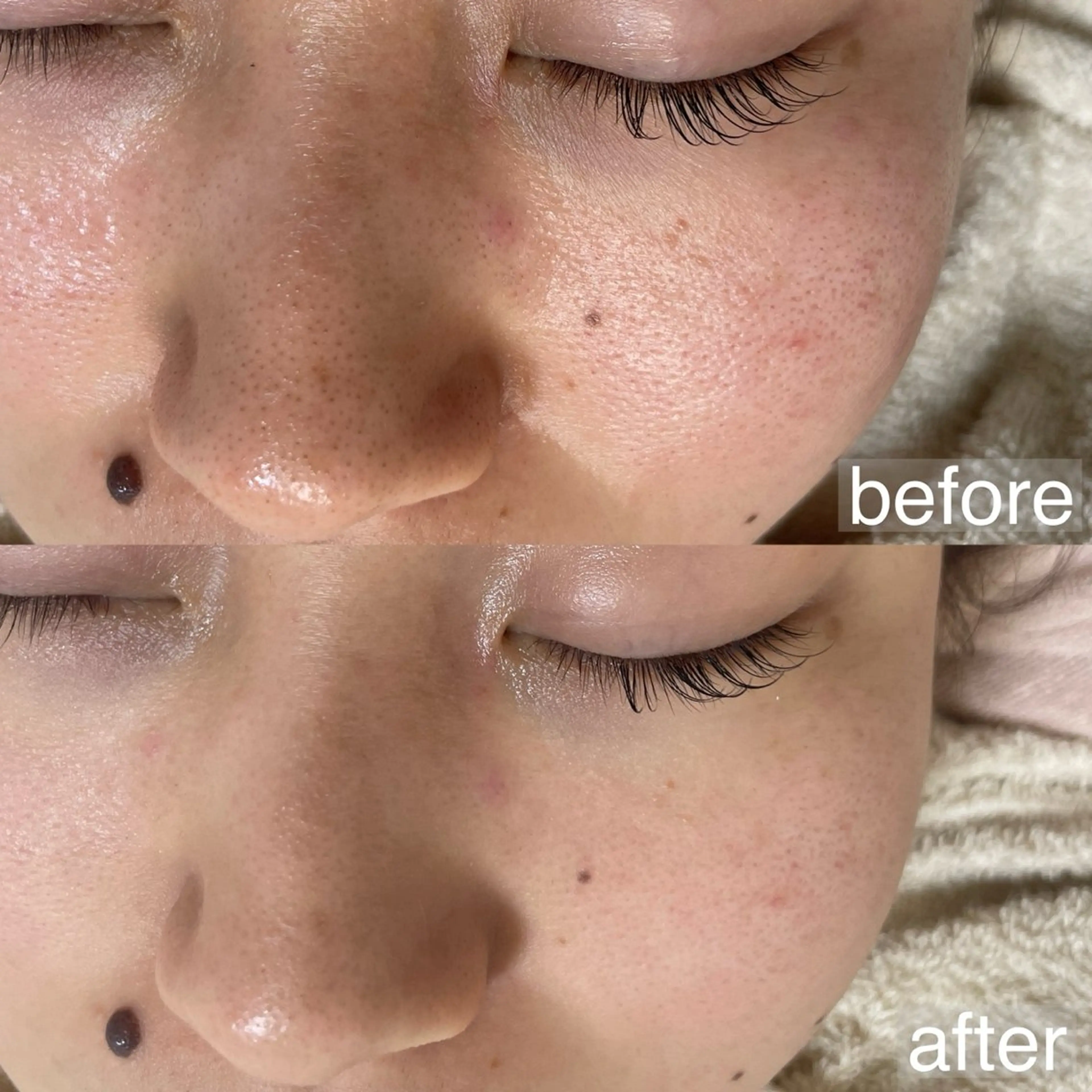 アイブロウ&フェイシャルサロンa‘lm所属・WAX脱毛/肌質改善 眉毛とお肌のサロンのエステ・リラクイメージ