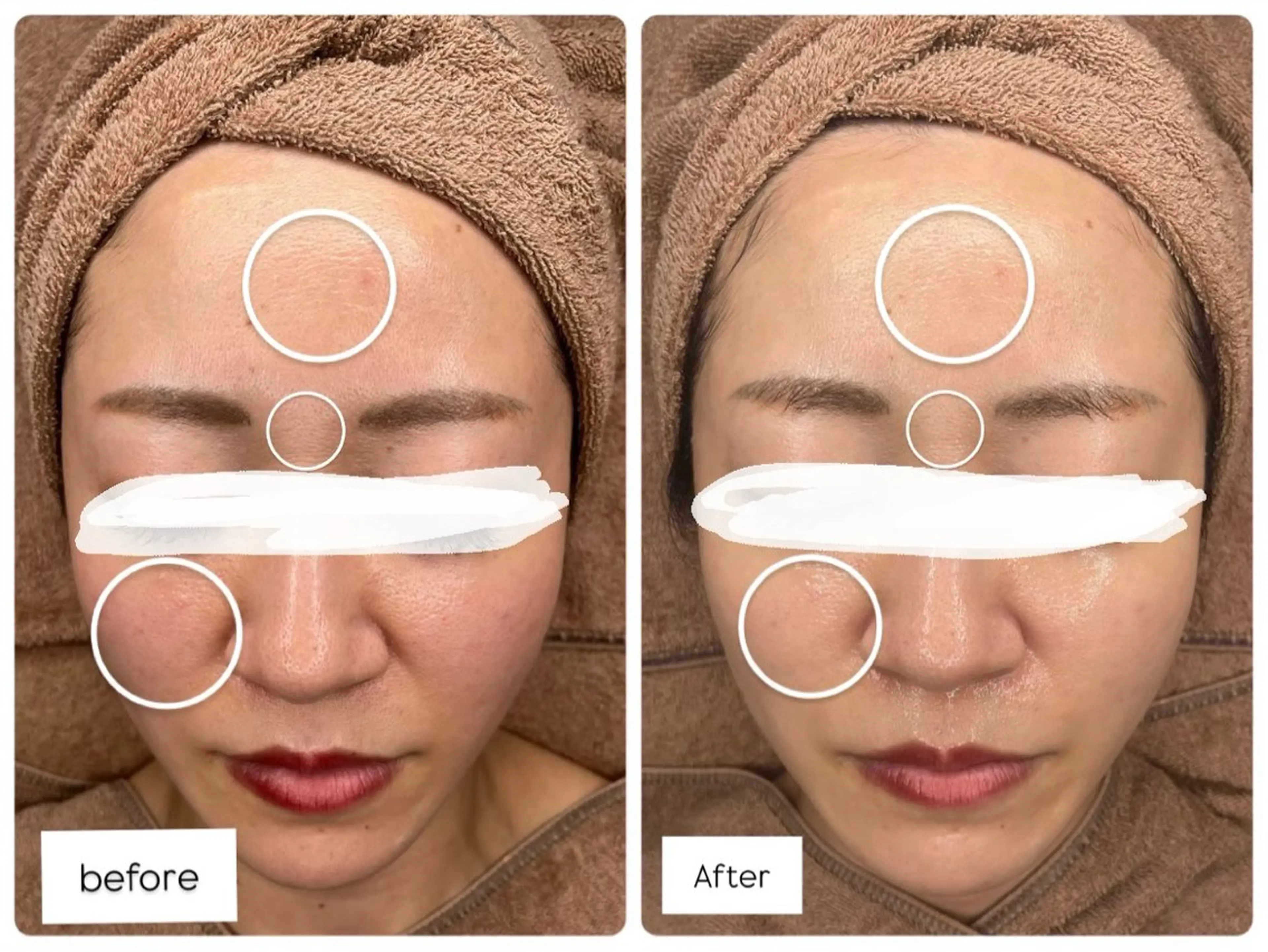 💎ボディエステ＆ 脱毛＆スパ💎山岡のエステ・リラクイメージ