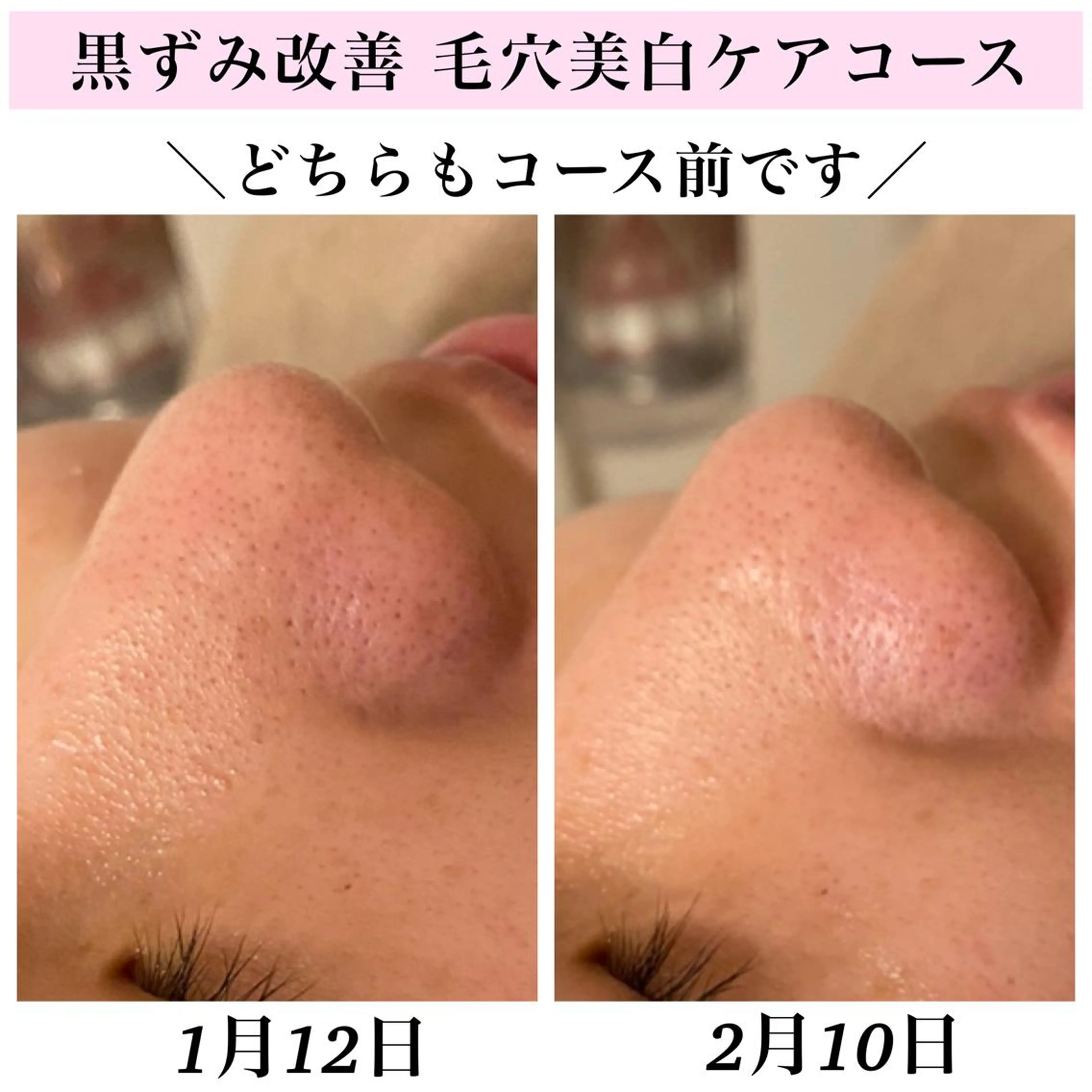 エステ リラク Bellesthe （ベルエステ）のエステ・リラクイメージ