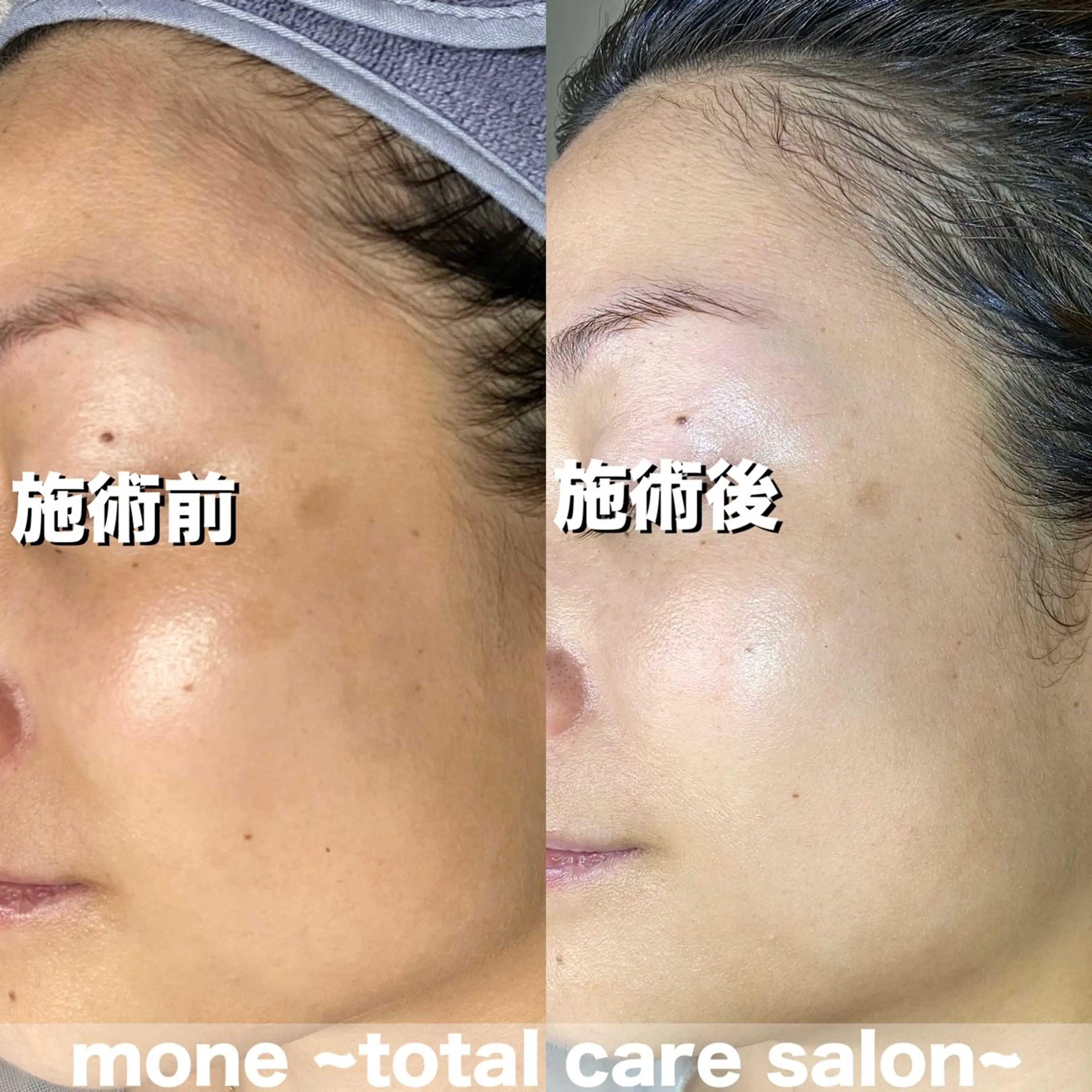 エステ mone~total care salon~所属・mone (モーネ)のエステ・リラクイメージ