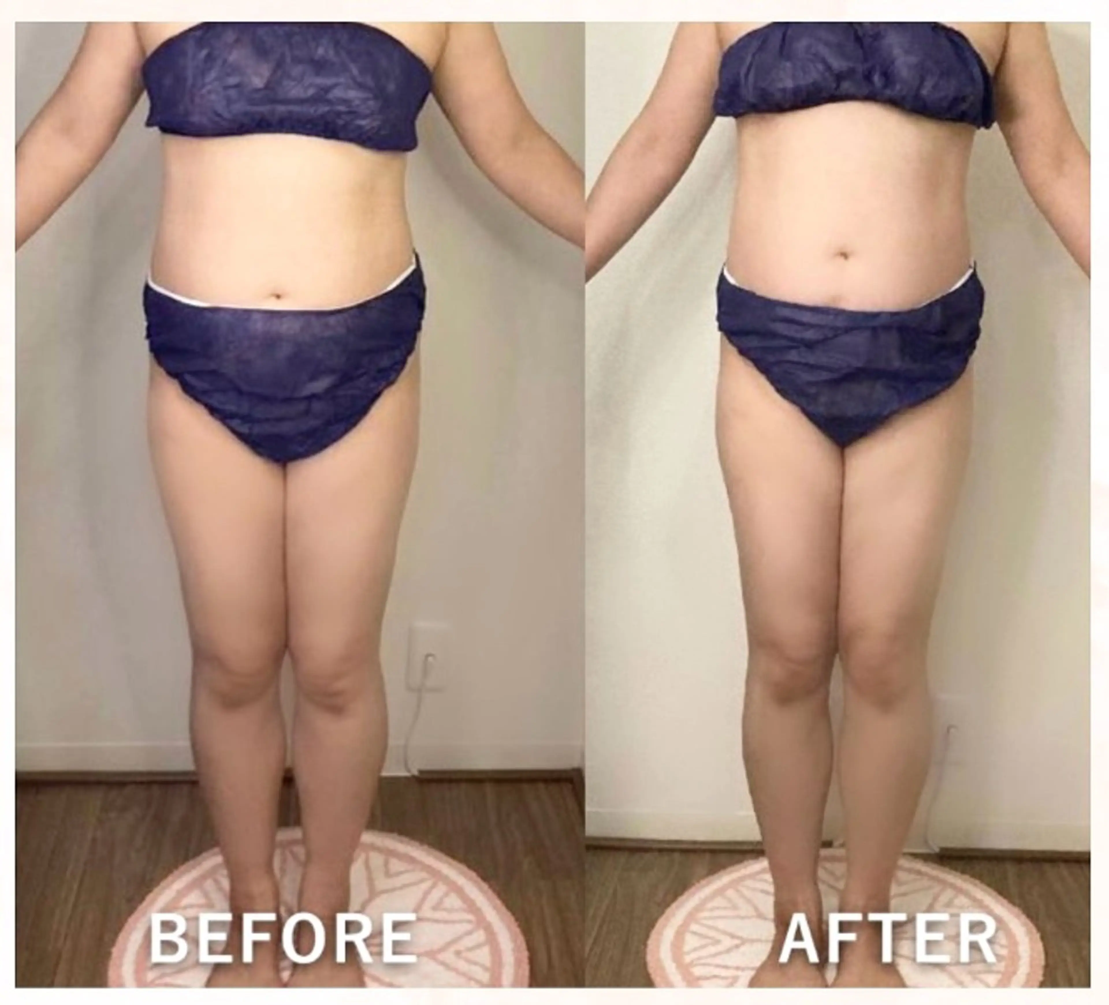 毛穴/いちご鼻/小顔 /hitohanaのエステ・リラクイメージ