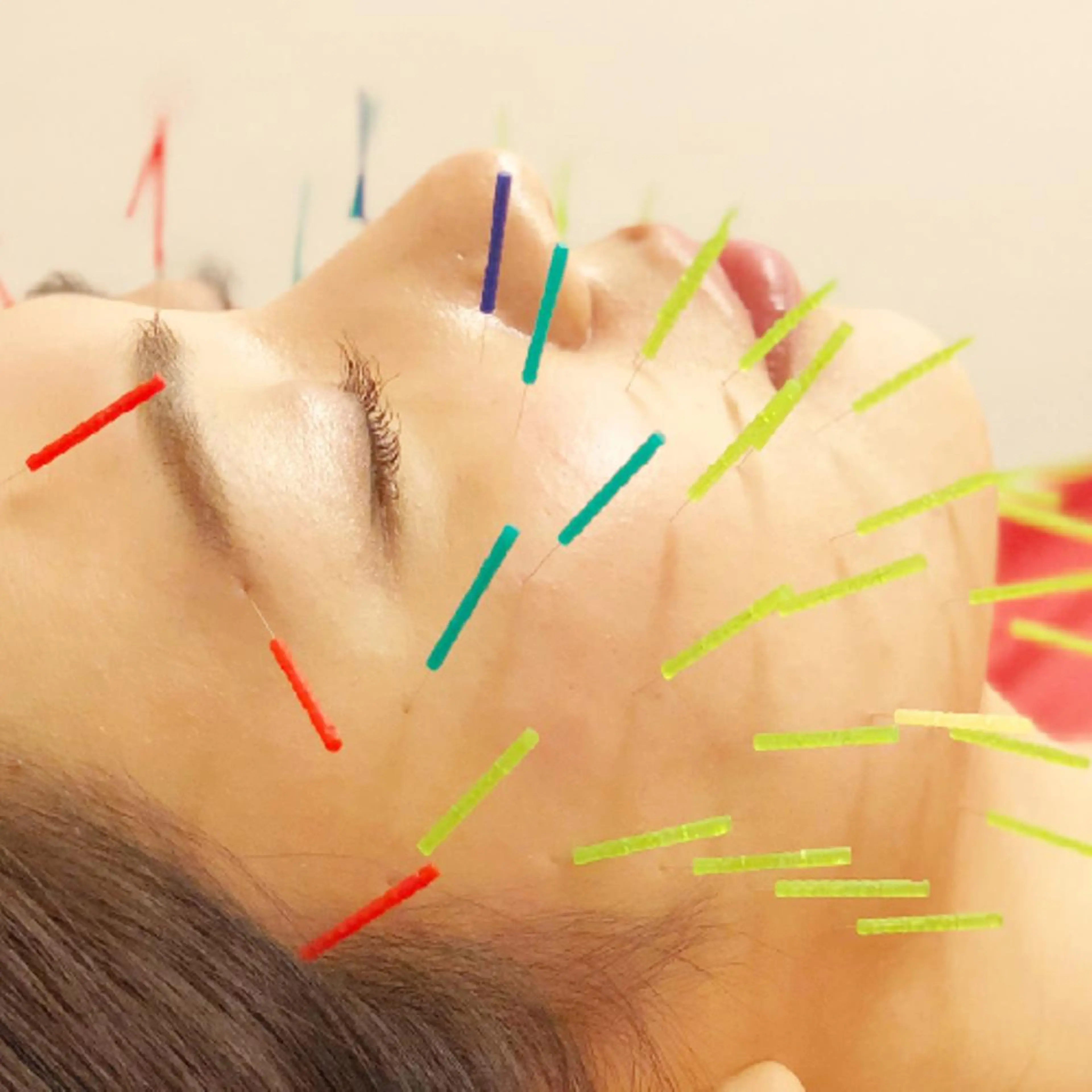 🌈 肌質改善 美容鍼🙌イイダ🌈のエステ・リラクイメージ