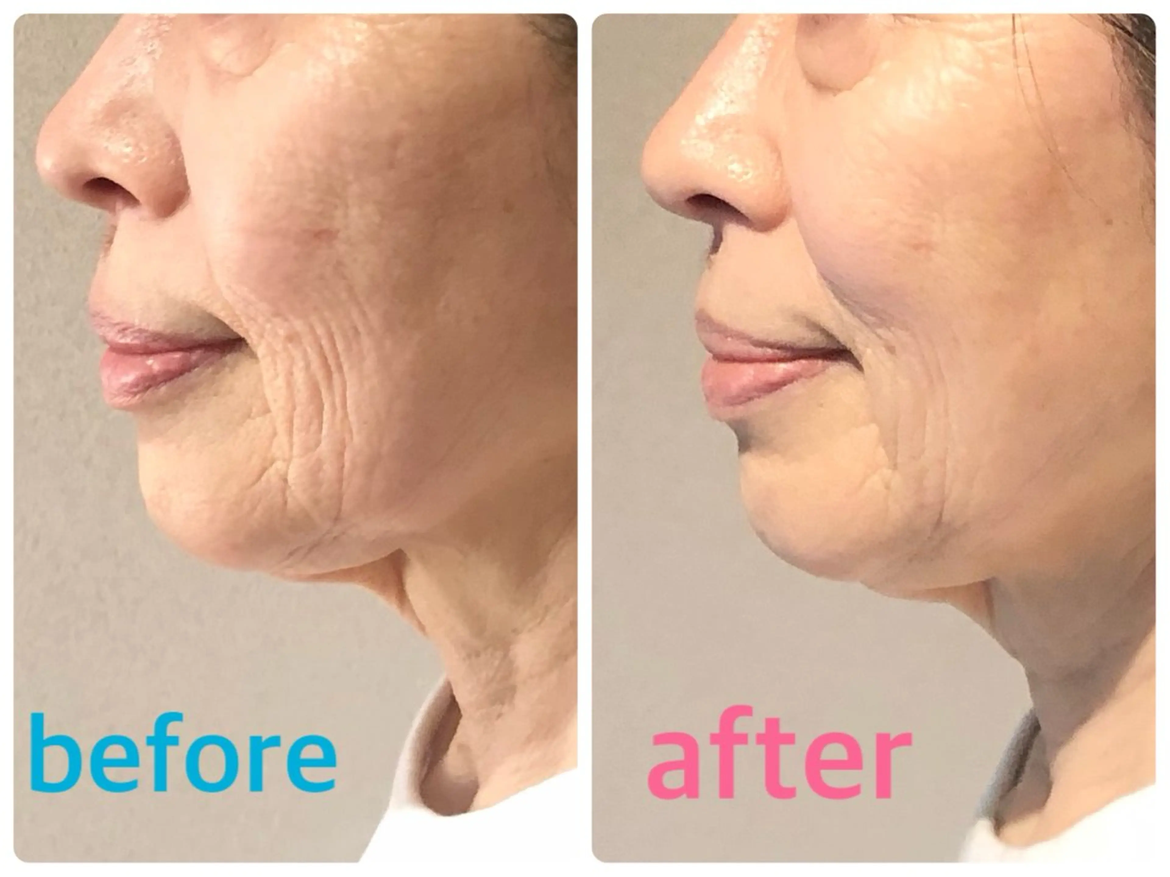 安眠ヘッドスパ整体 🌿白金/目黒/鈴木のエステ・リラクイメージ