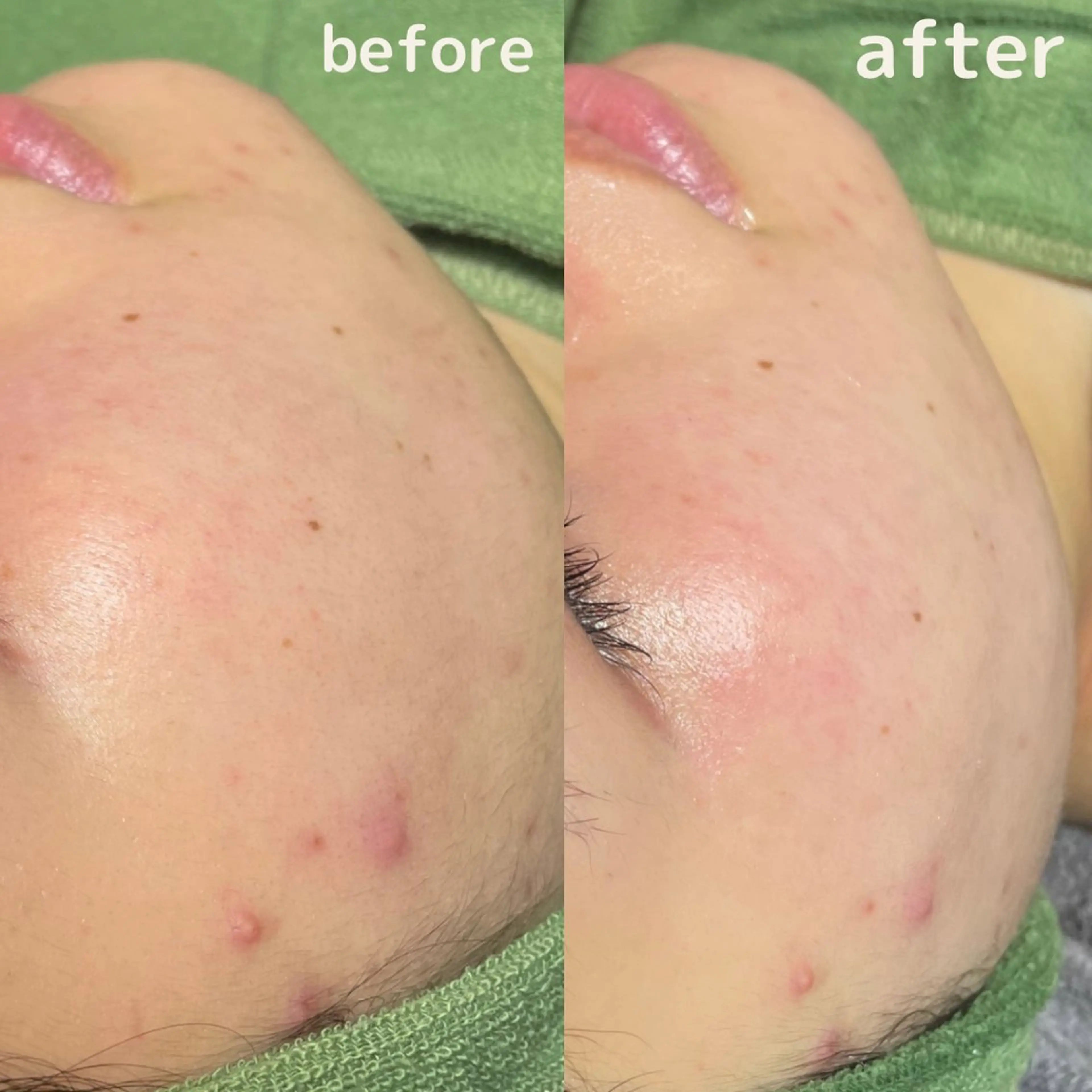 エステ リラク if byOrab riller【ｲﾌ】のその他イメージ