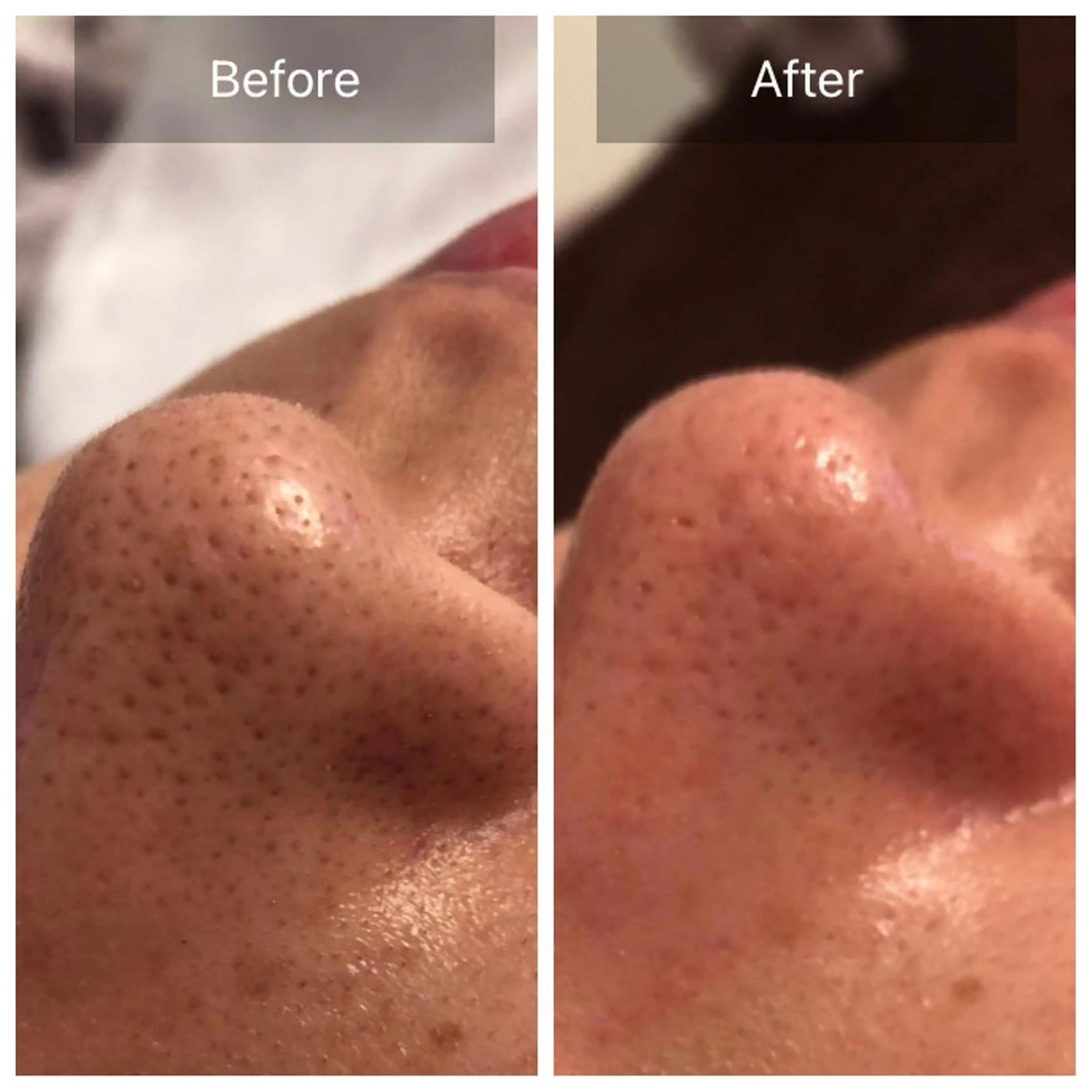 エステ Lumiere despoir所属・Lumiere despoirのエステ・リラクイメージ