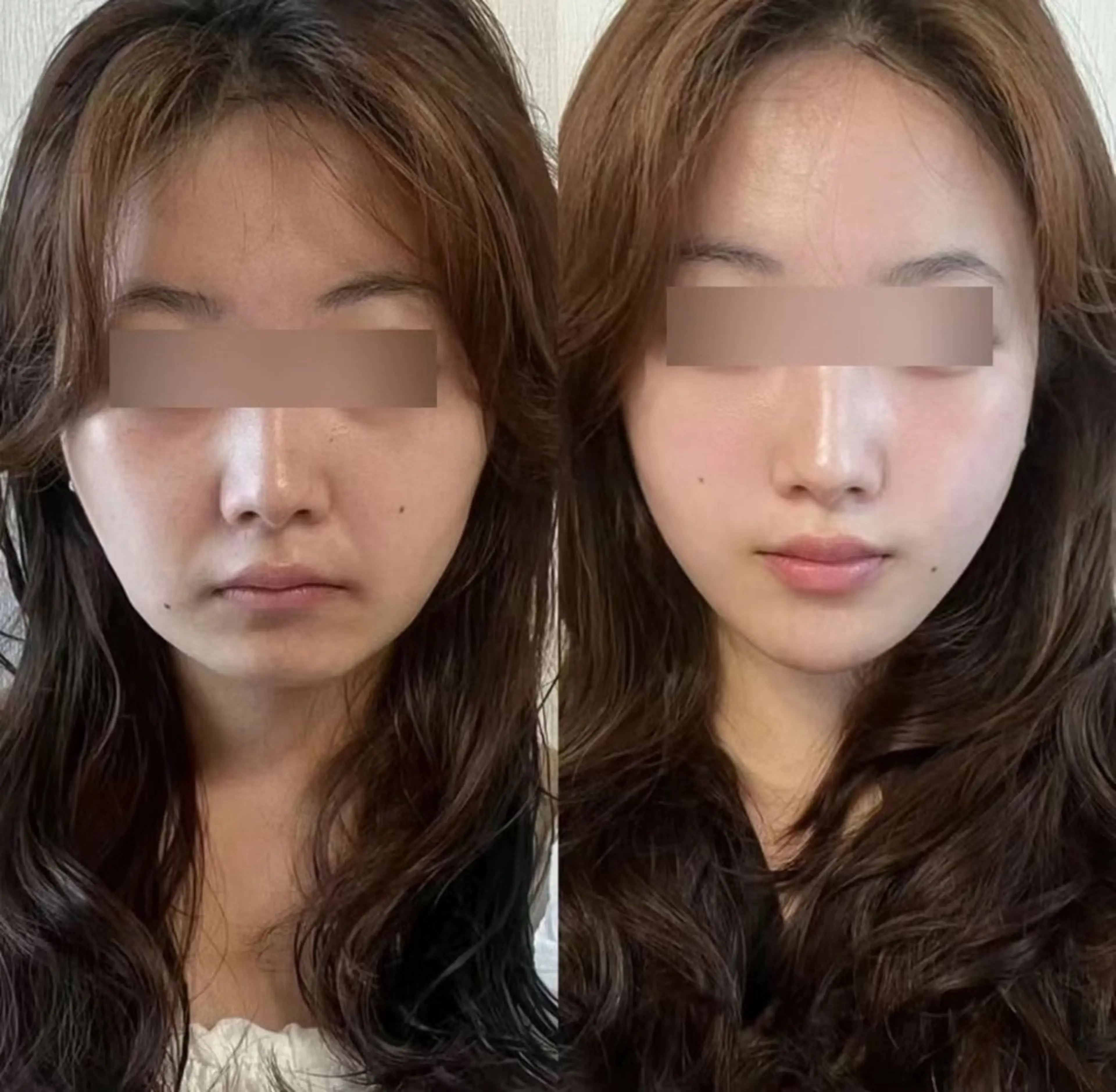 カラー aliaハーブ水光店 エステティシャン募集のエステ・リラクイメージ