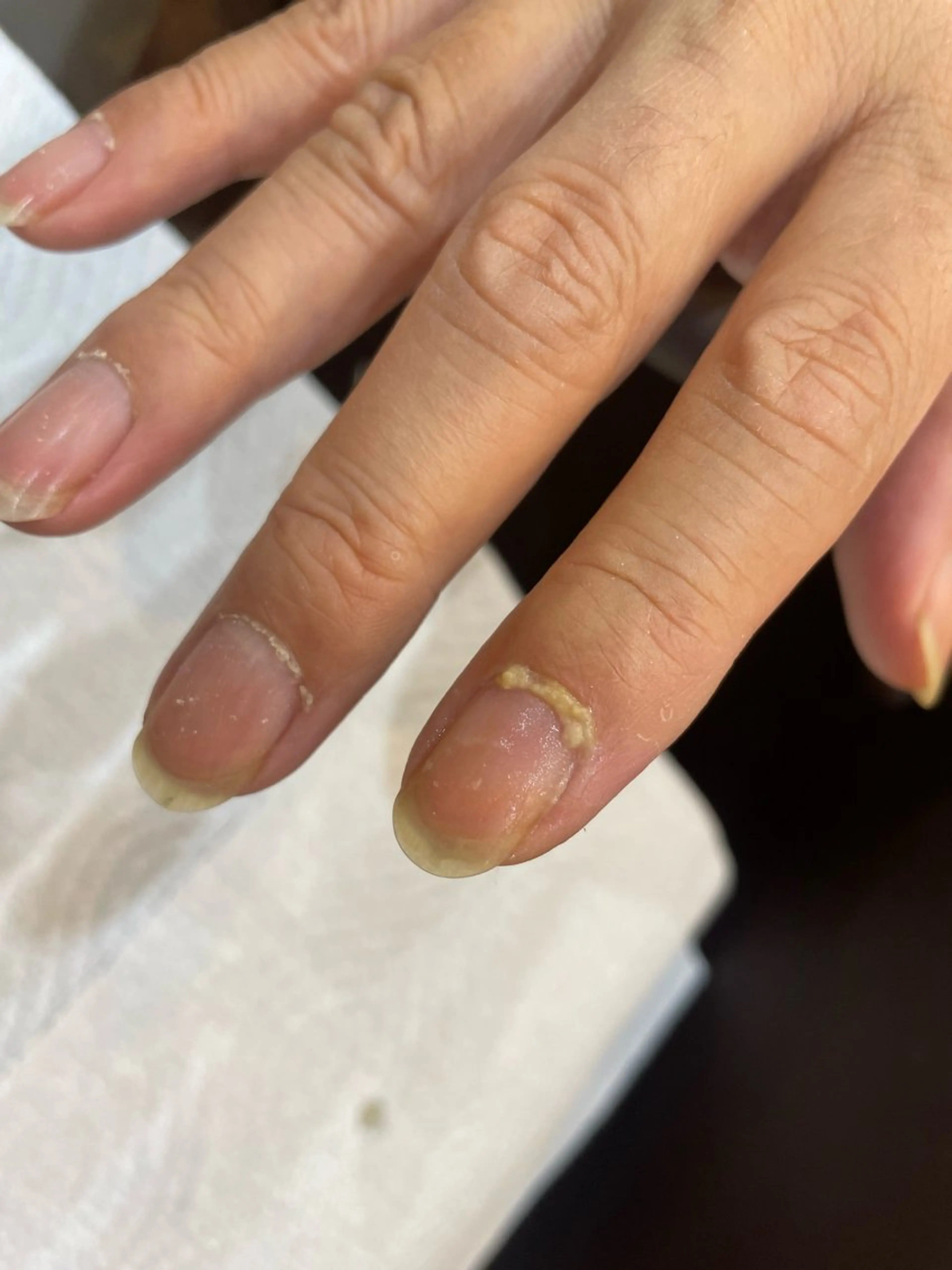 ネイル sawasaki kotomiのネイルデザイン