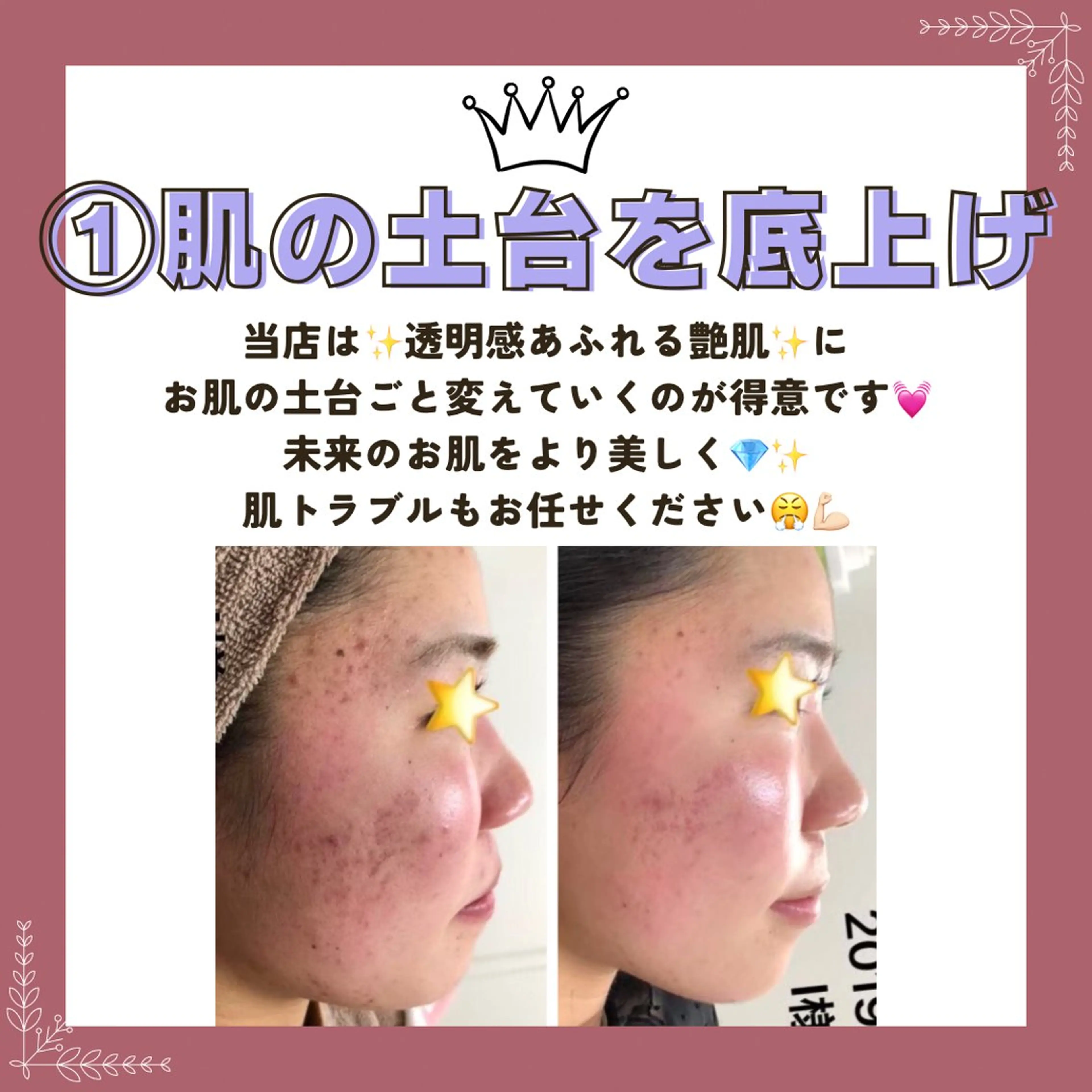 エステ Prima 〜プリマ栄店〜のエステ・リラクイメージ