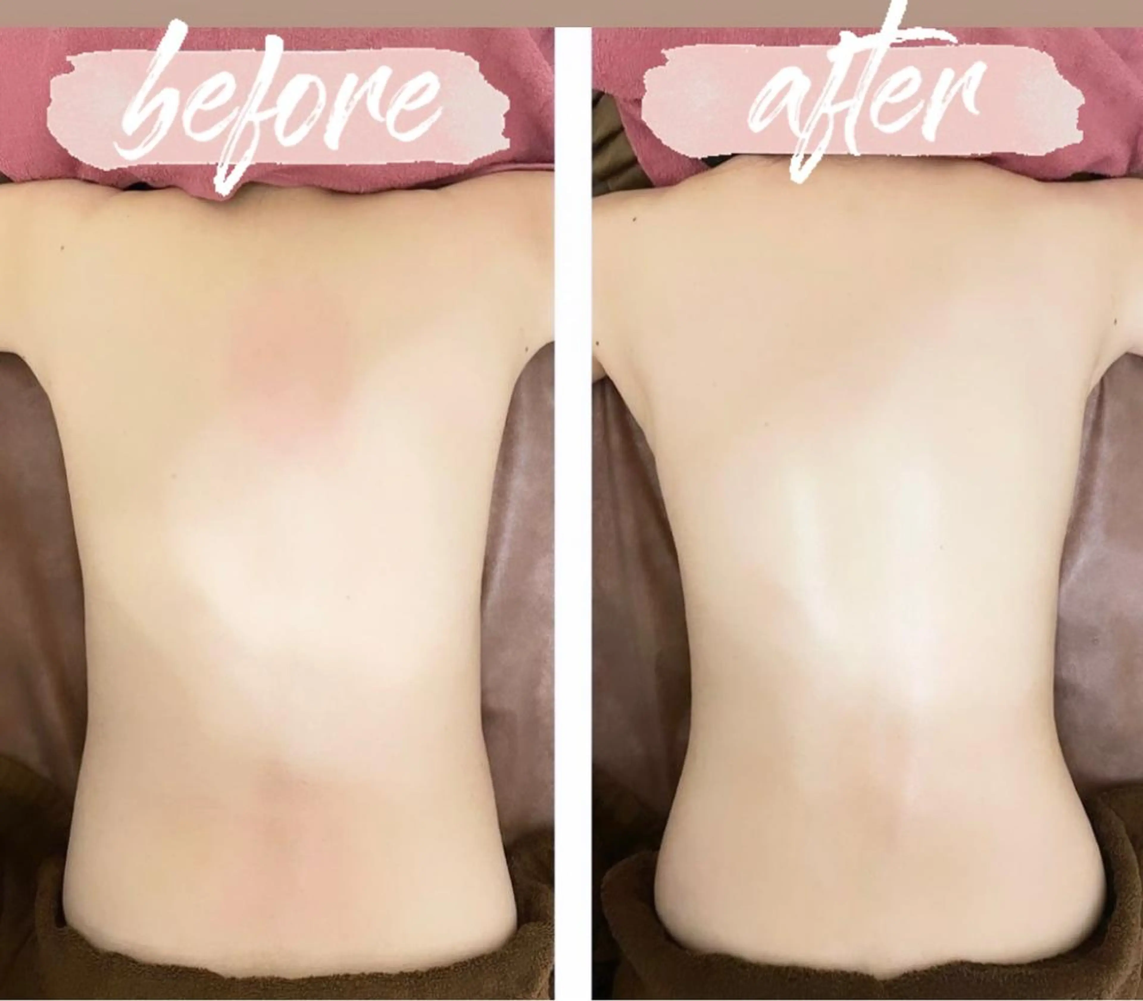 エステ 35歳からの エイジングケアサロンのエステ・リラクイメージ