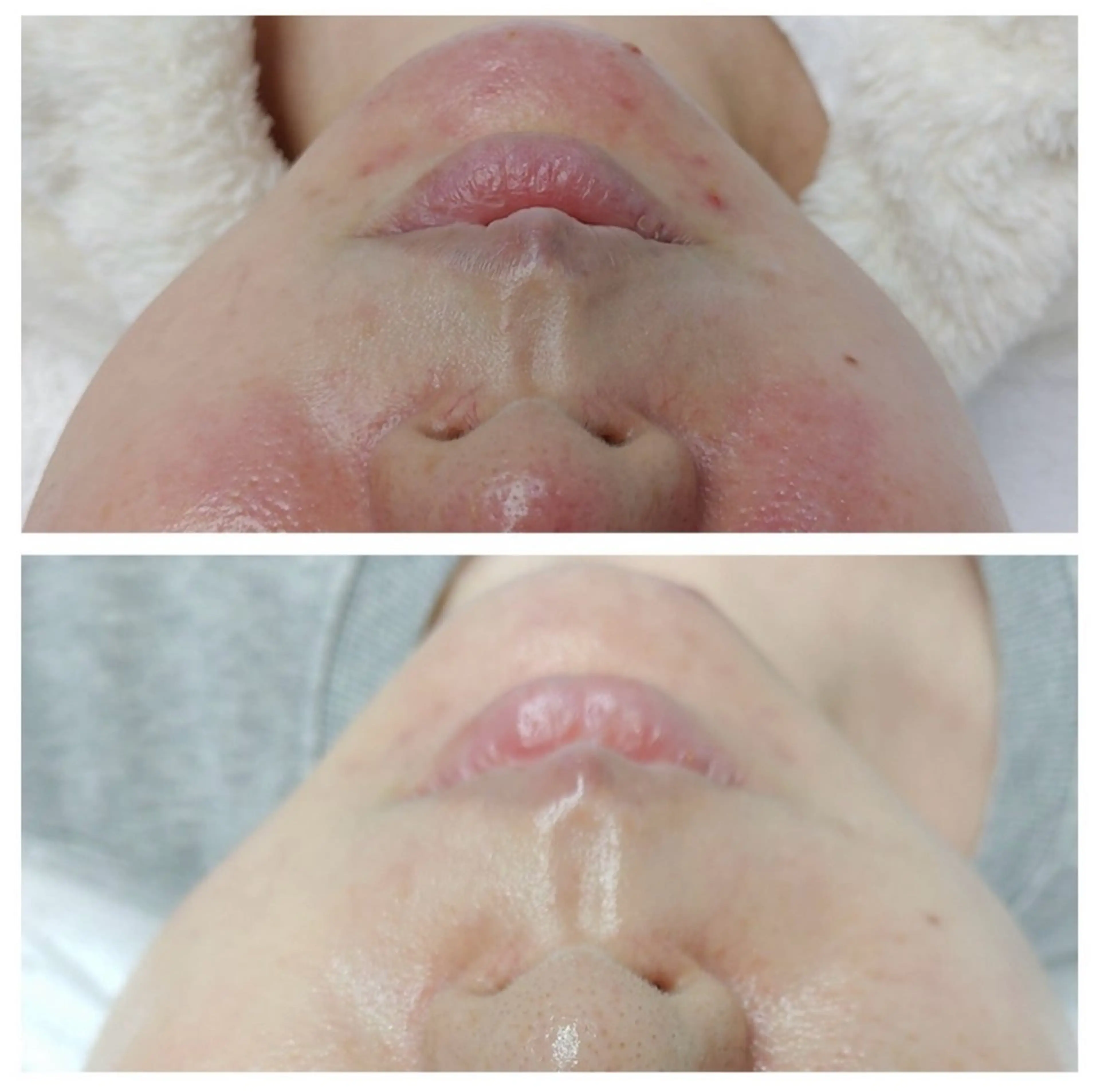 エステ 看護師が施術する美容 ナスサロ/石橋のエステ・リラクイメージ