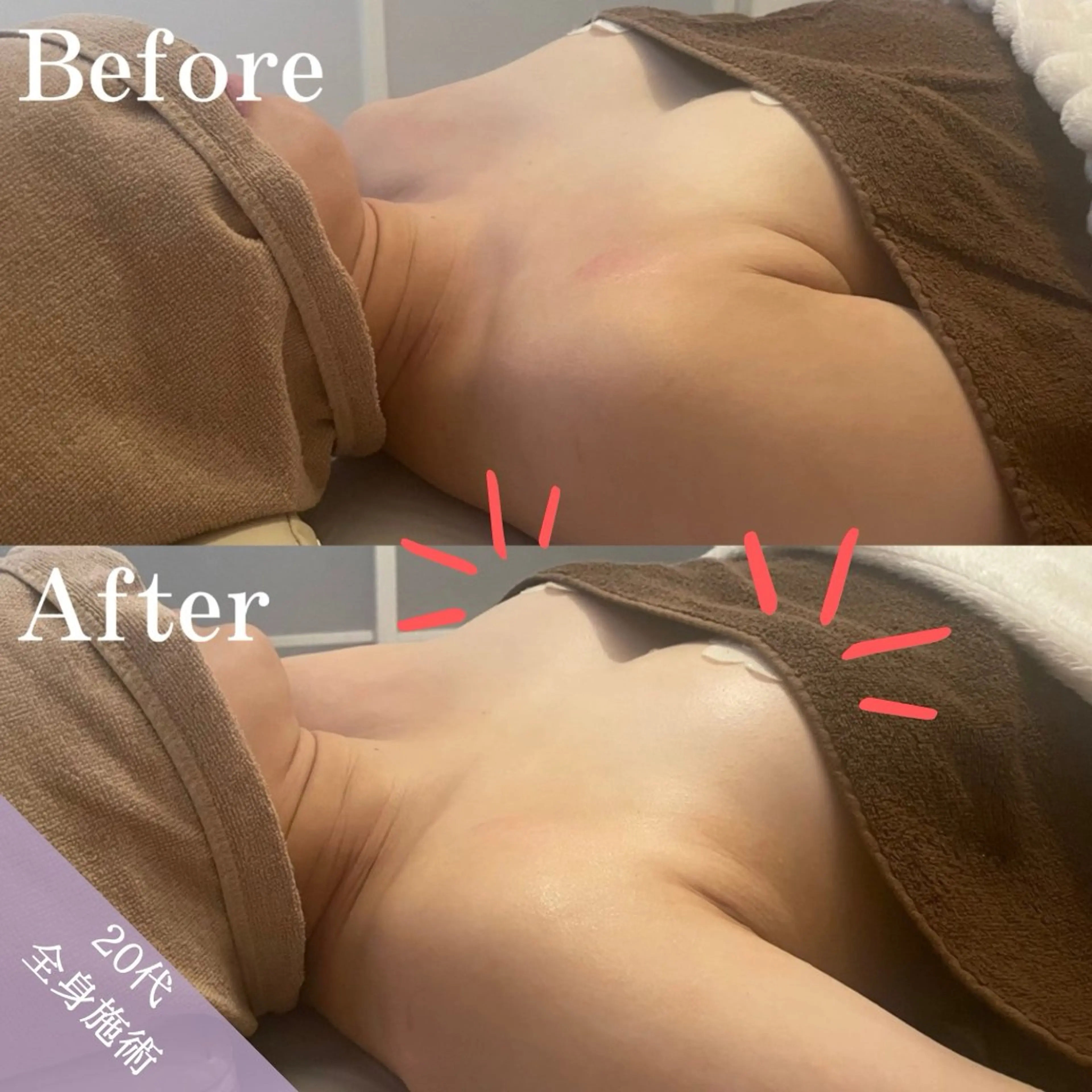 【バストアップ全身☆超贅沢フルコース】専門店による本気のバストアップをもう一度*90分施術の写真