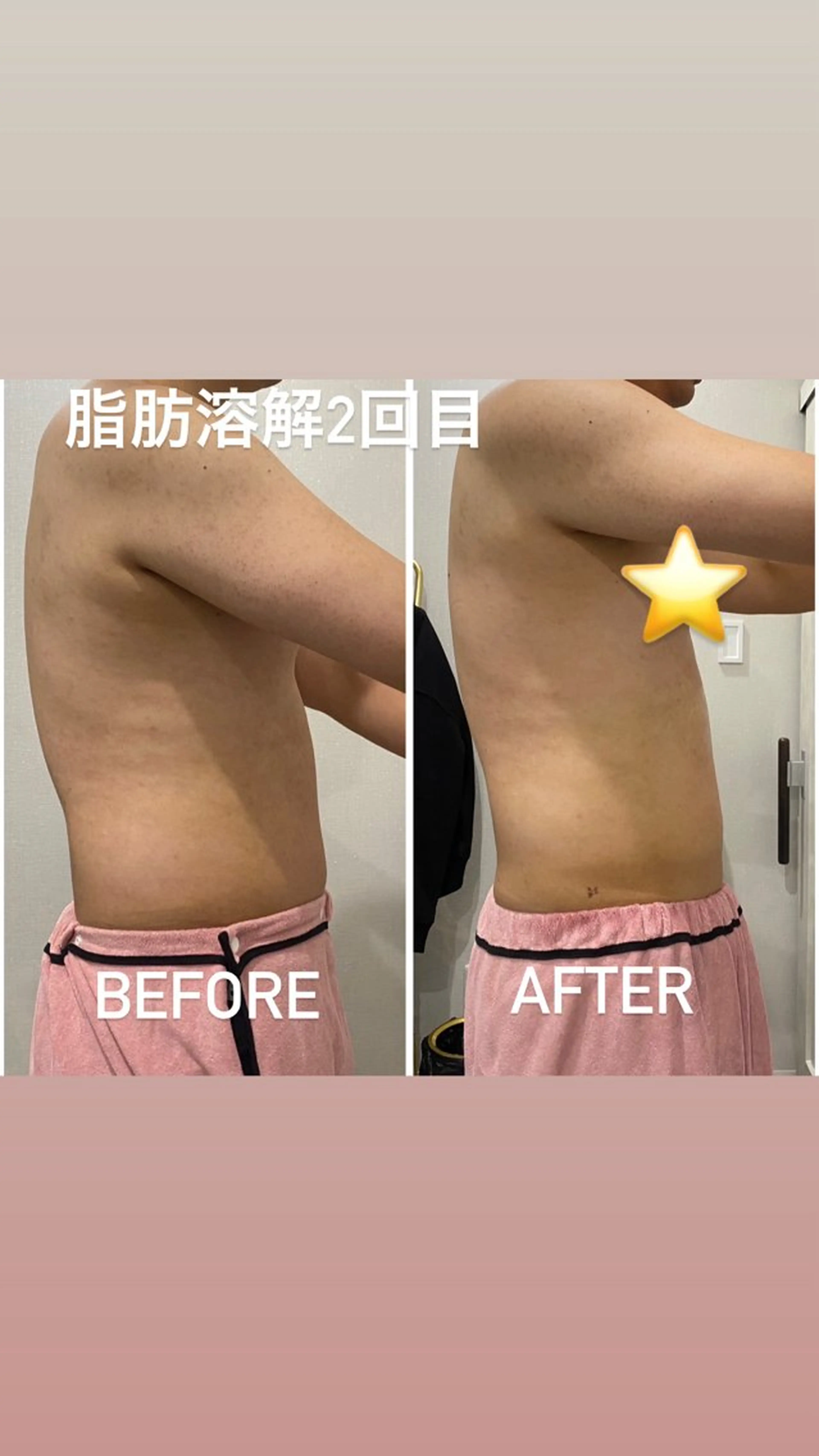 エステ 毛穴洗浄・痩身・脱毛 /アルカンジュのエステ・リラクイメージ