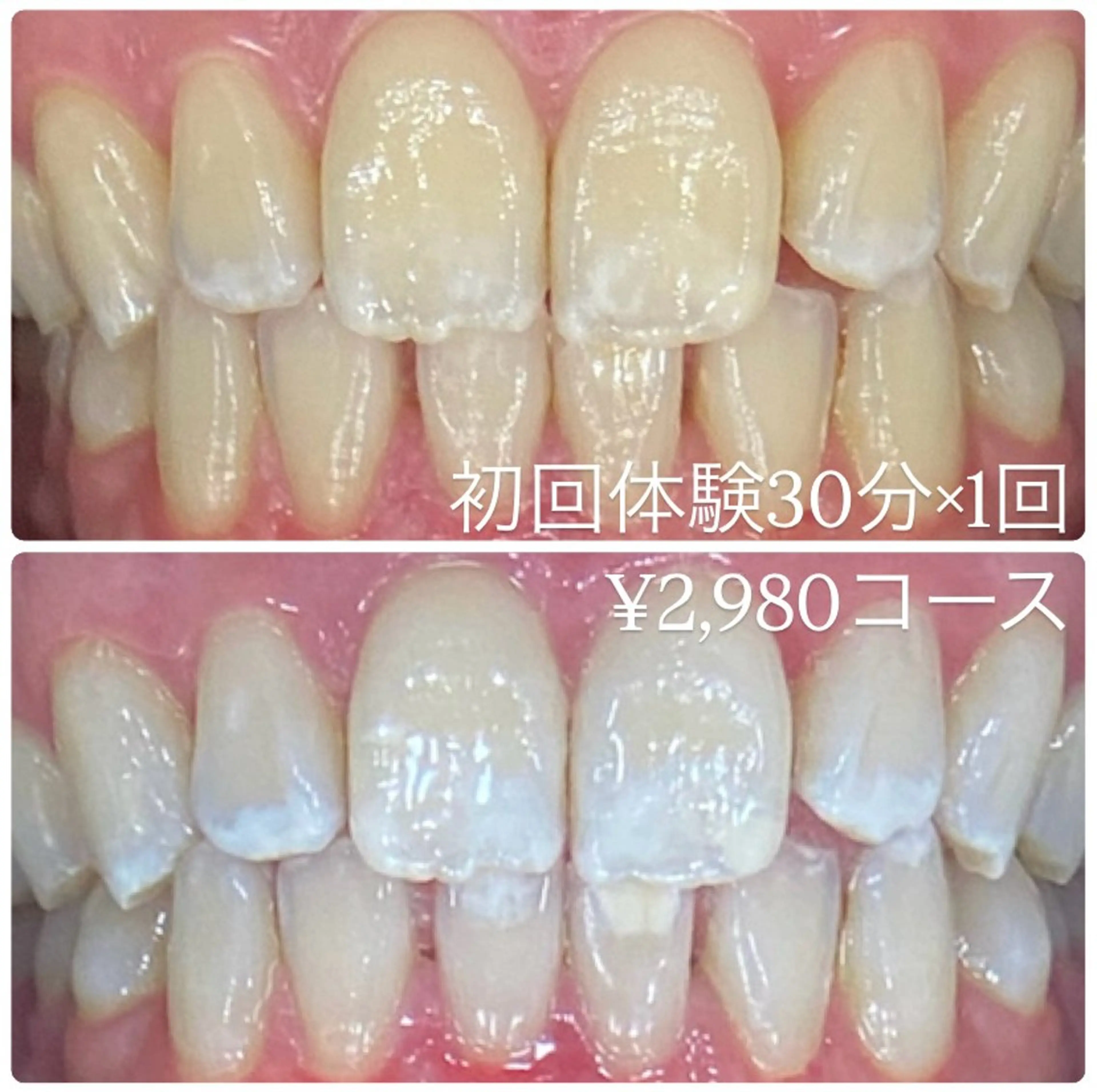 ホワイトニングルーム 横浜店のその他イメージ