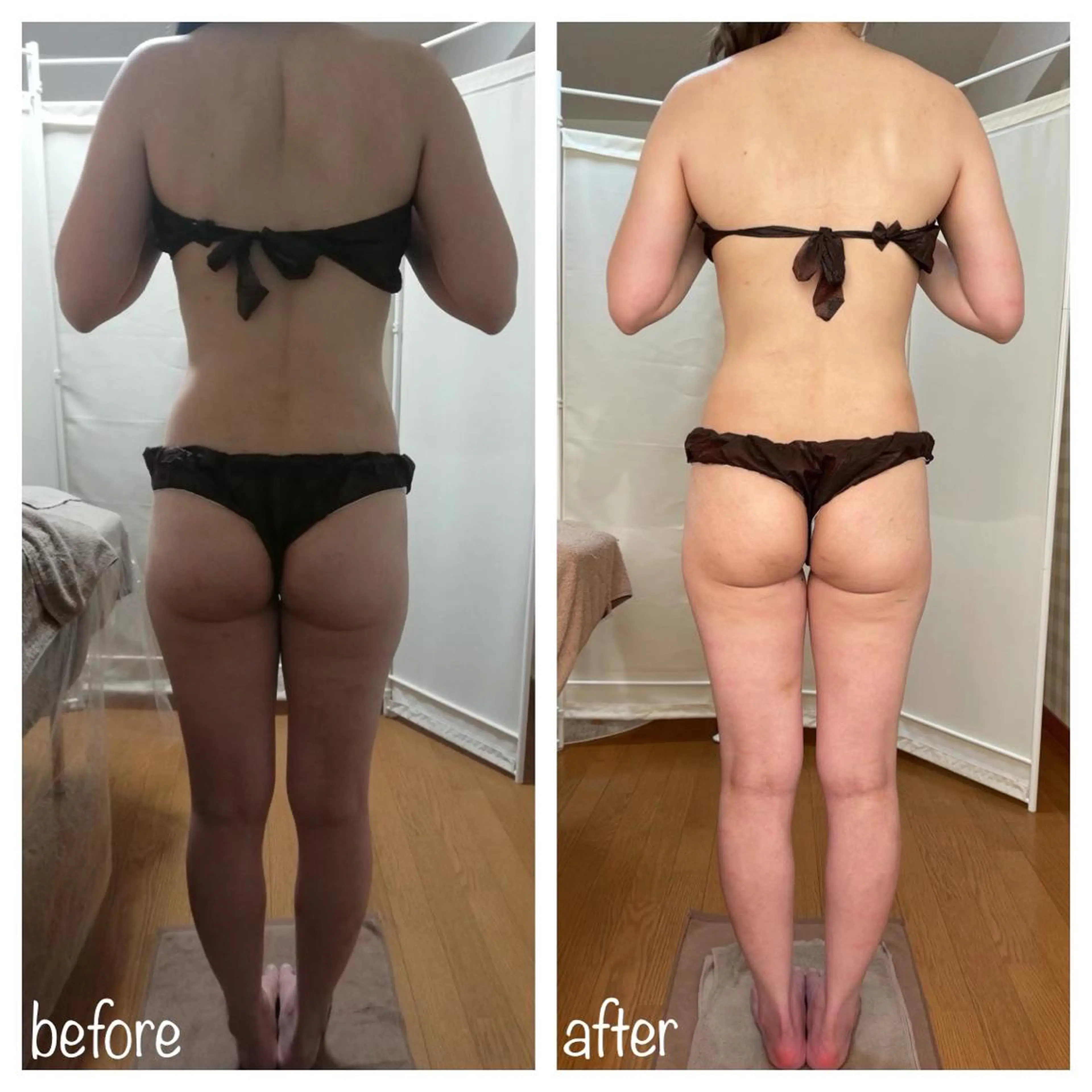 《本気痩せ×疲労改善 》  BILOOPのエステ・リラクイメージ