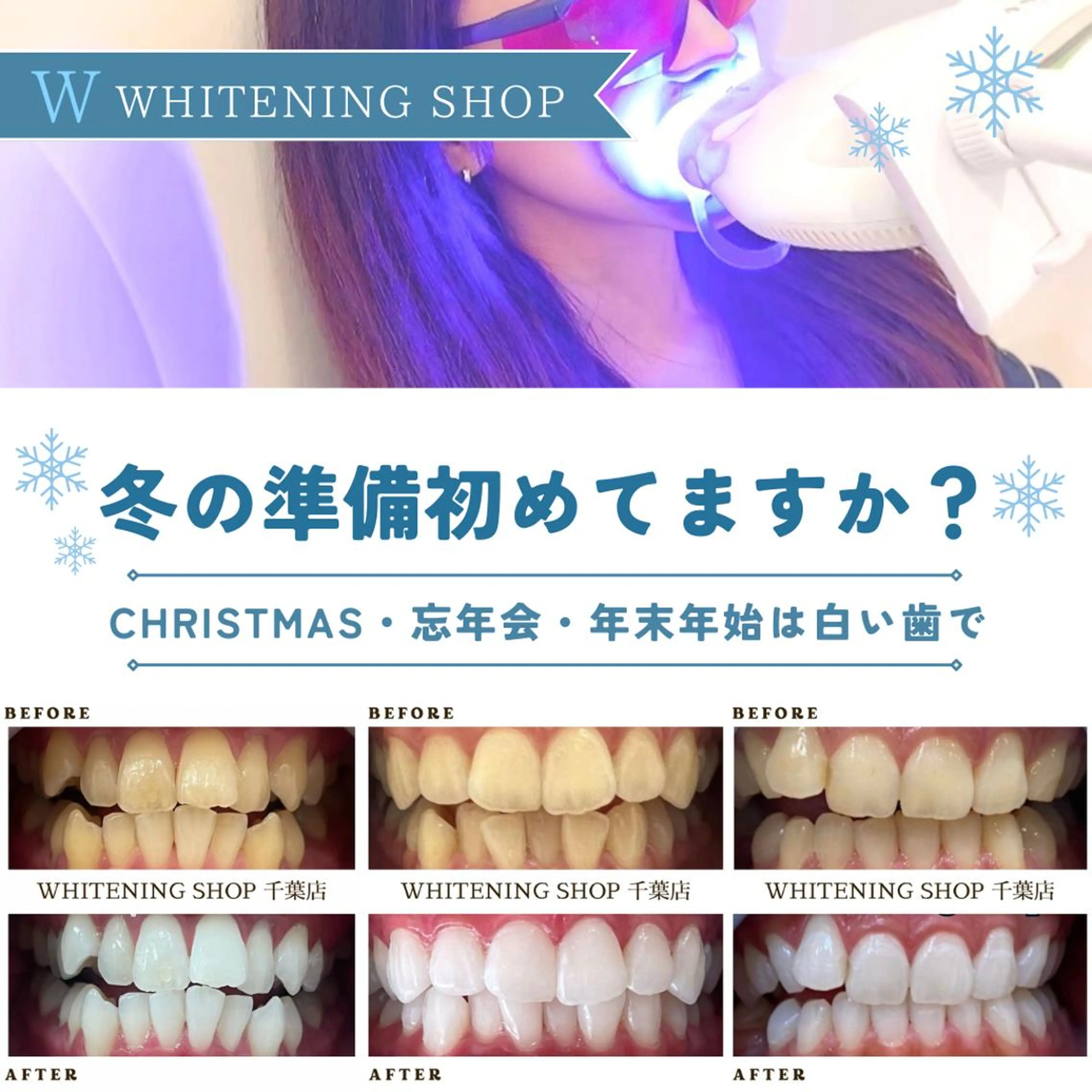 メンズ クリスマス ホワイトニング ショップ千葉店のその他イメージ