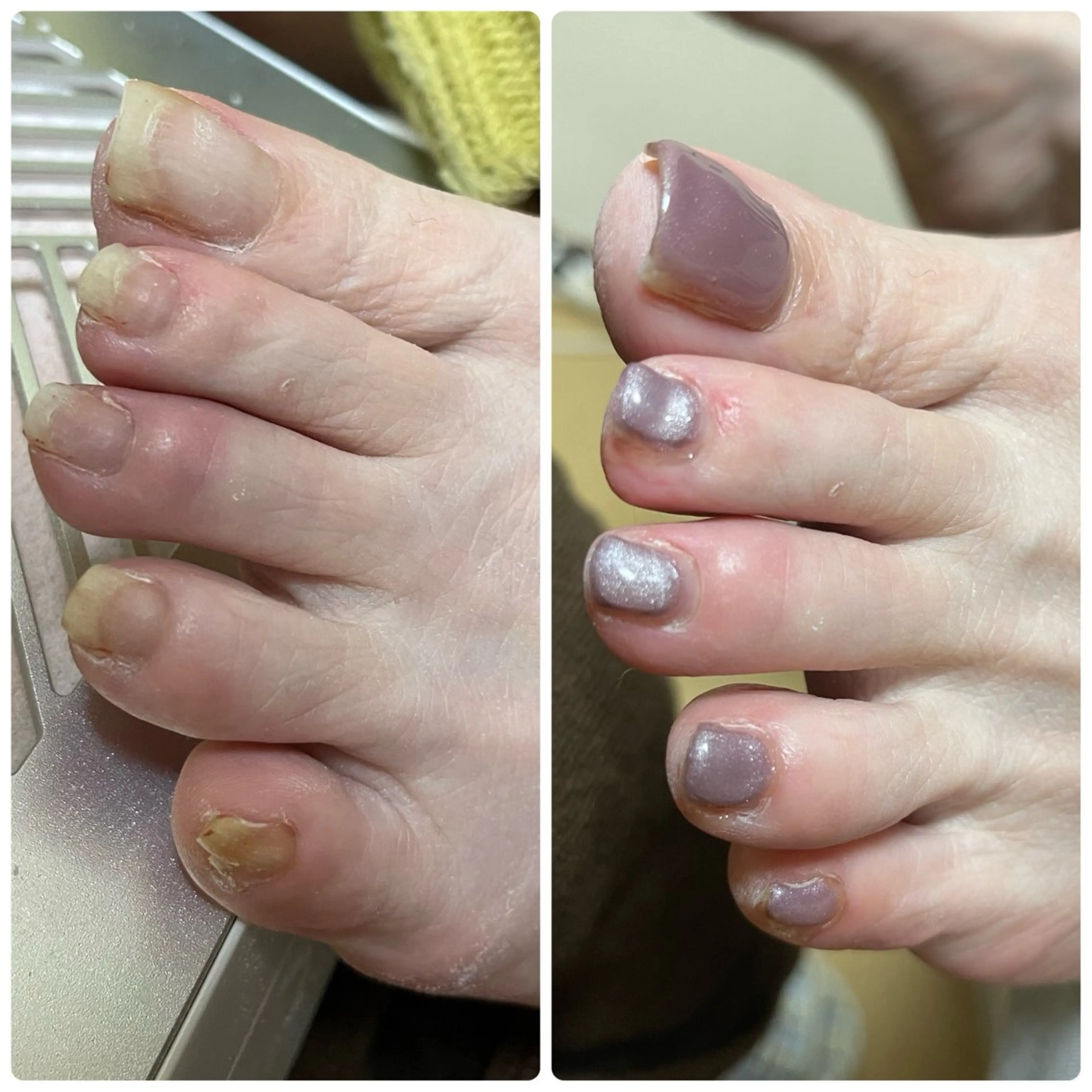 ネイル フットネイル ワンカラーネイル 🔰 新米ネイリストのネイルデザイン