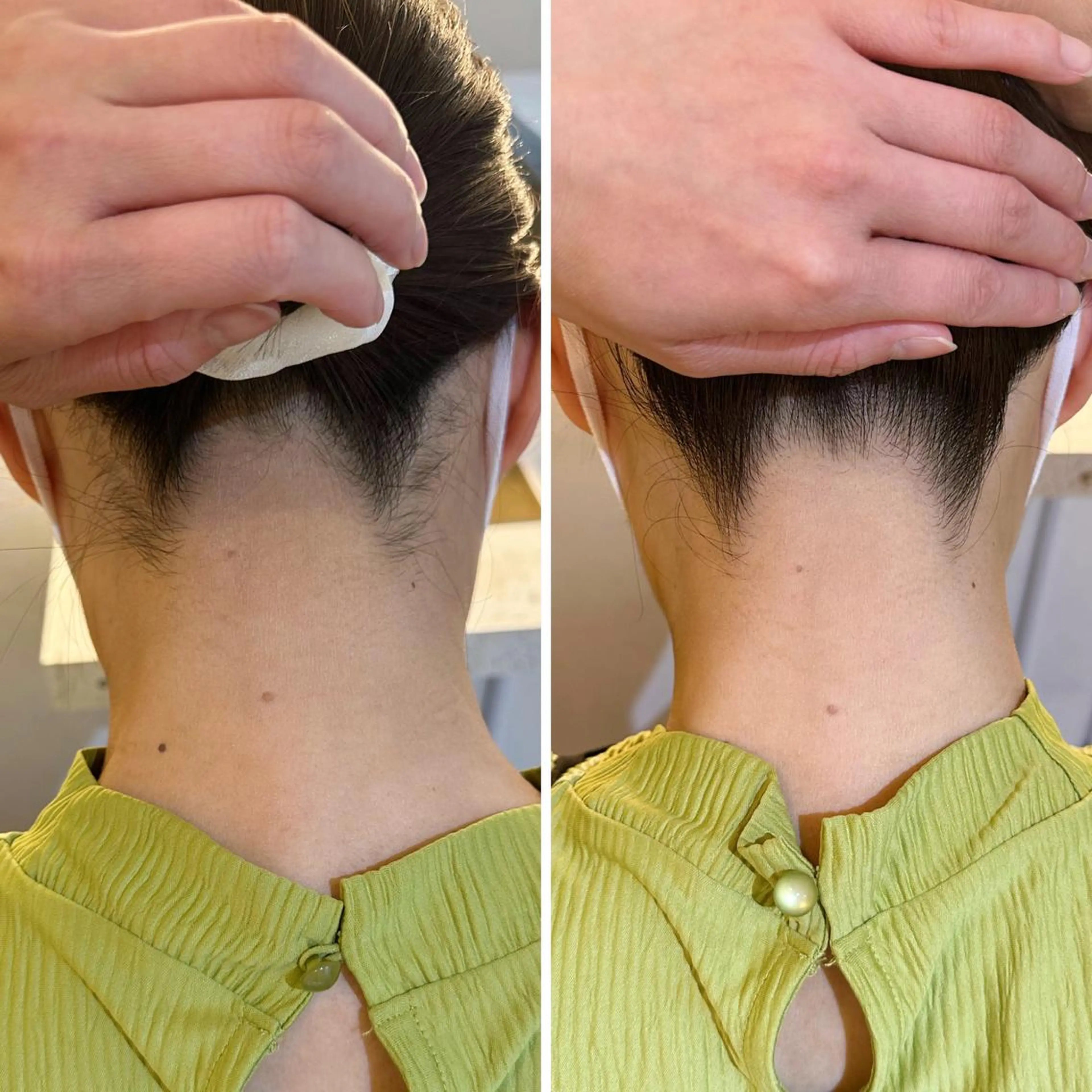 脱毛 うなじ脱毛/美肌脱毛 LABELのエステ・リラクイメージ